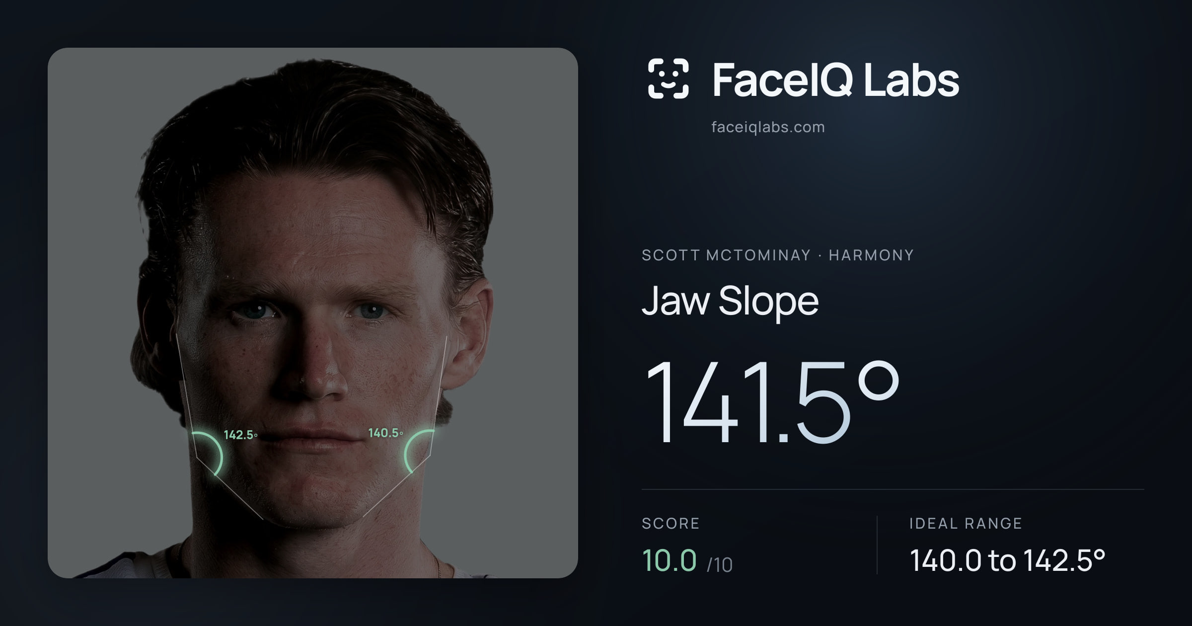 Scott Mctominay Jaw Slope: 141.5°, drawn on the photo