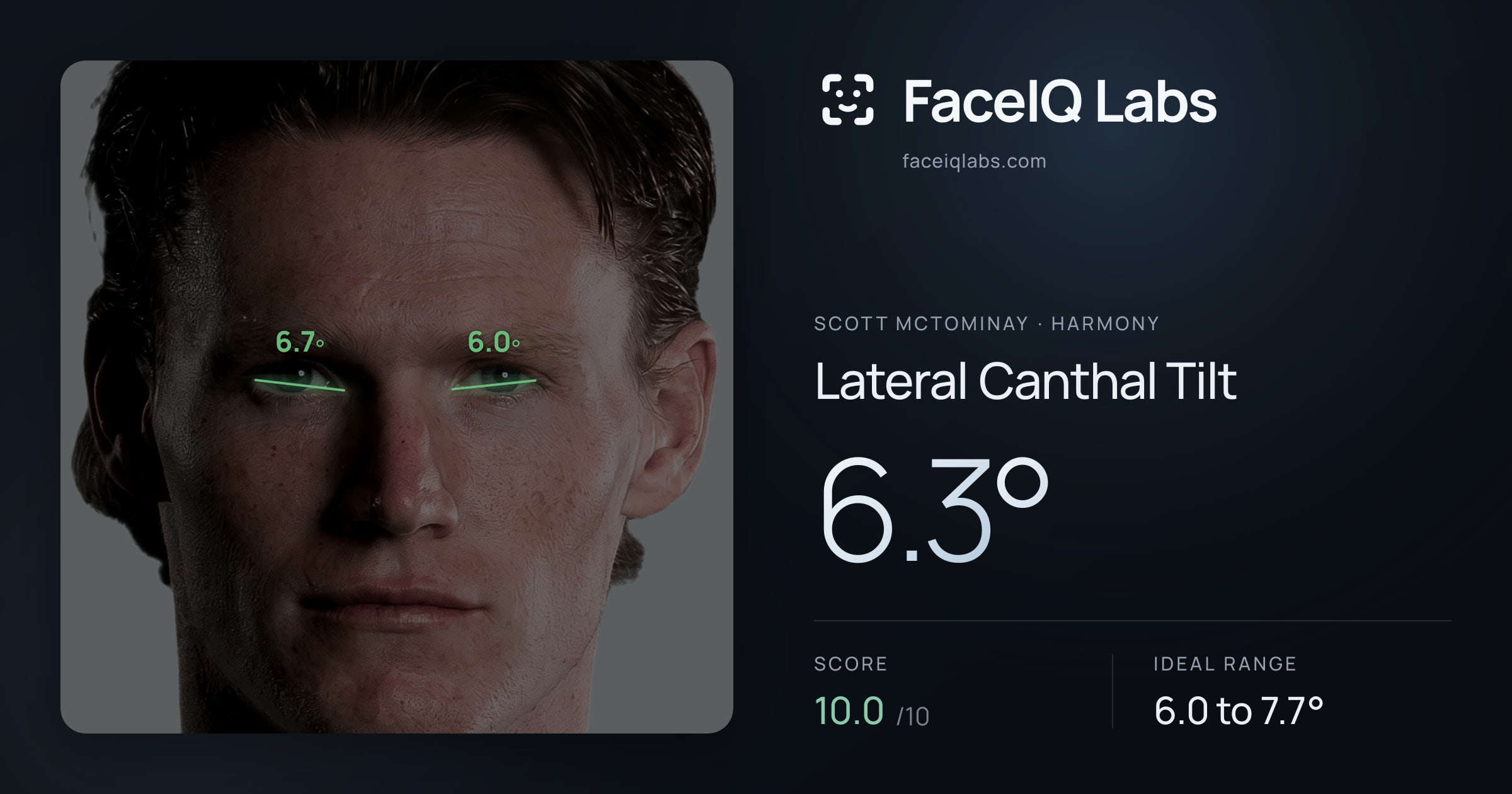 Scott Mctominay Lateral Canthal Tilt: 6.3°, drawn on the photo