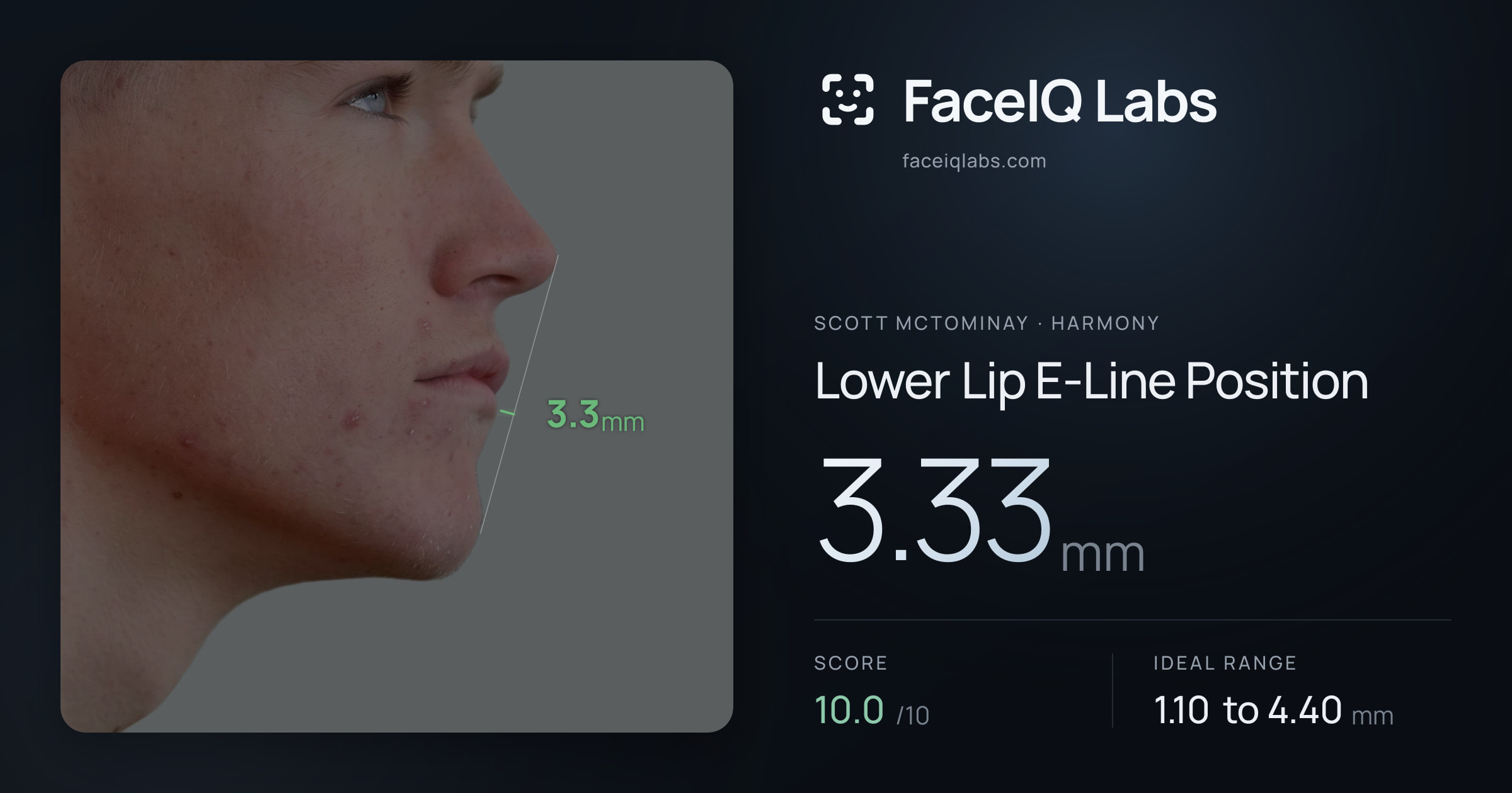 Scott Mctominay Lower Lip E-Line Position: 3.33mm, drawn on the photo