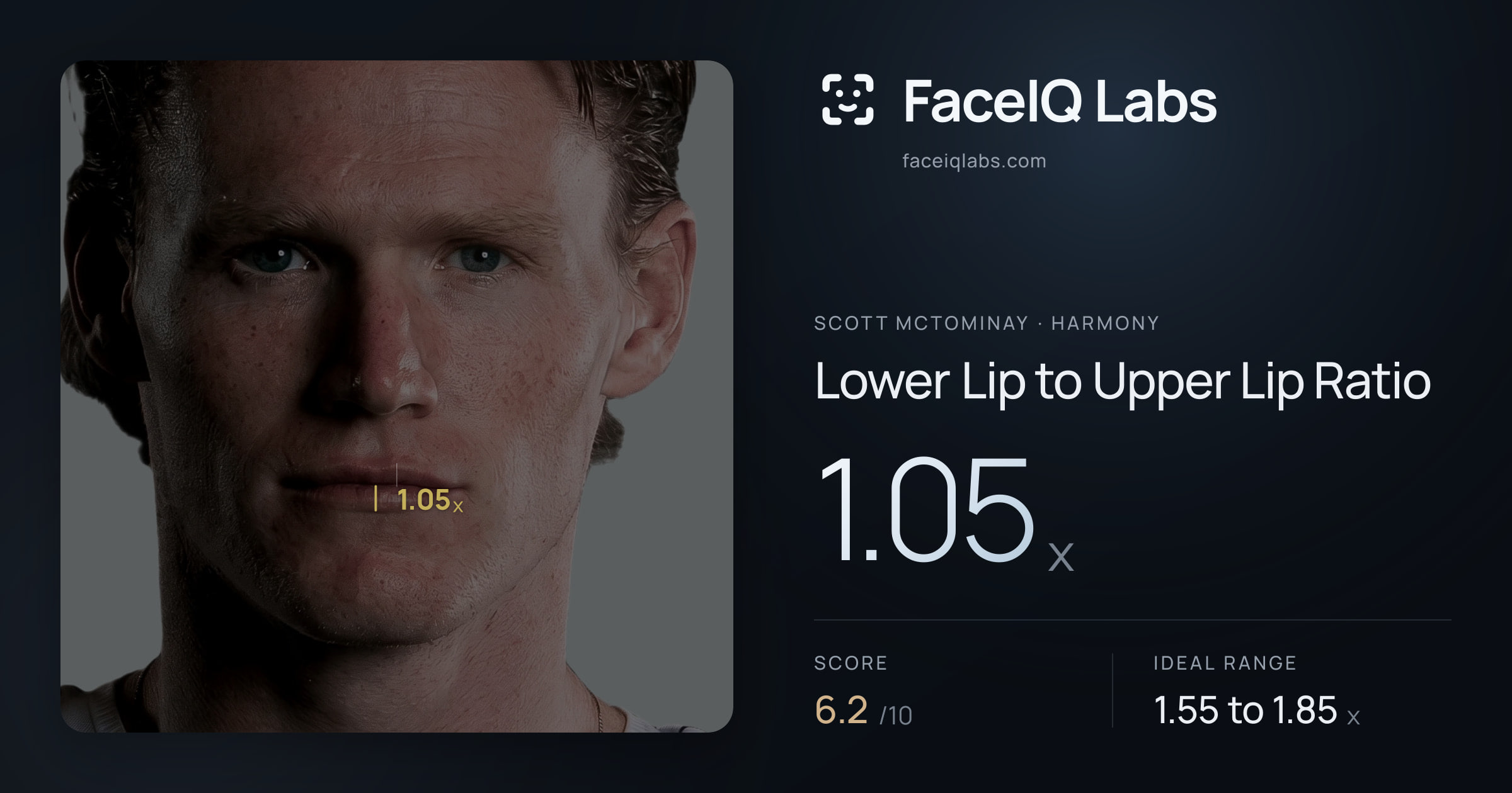 Scott Mctominay Lower Lip to Upper Lip Ratio: 1.05x, drawn on the photo