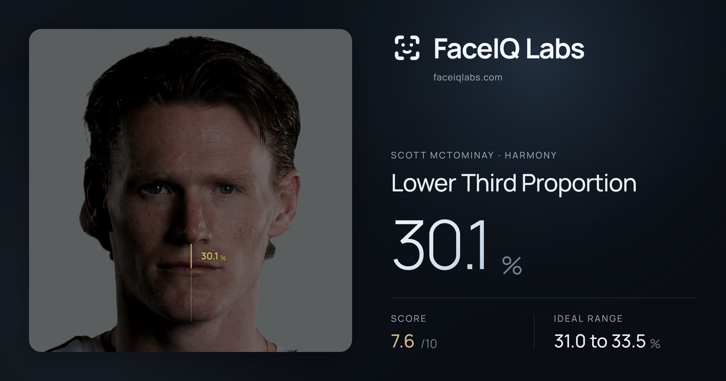 Scott Mctominay Lower Third Proportion: 30.1%, drawn on the photo