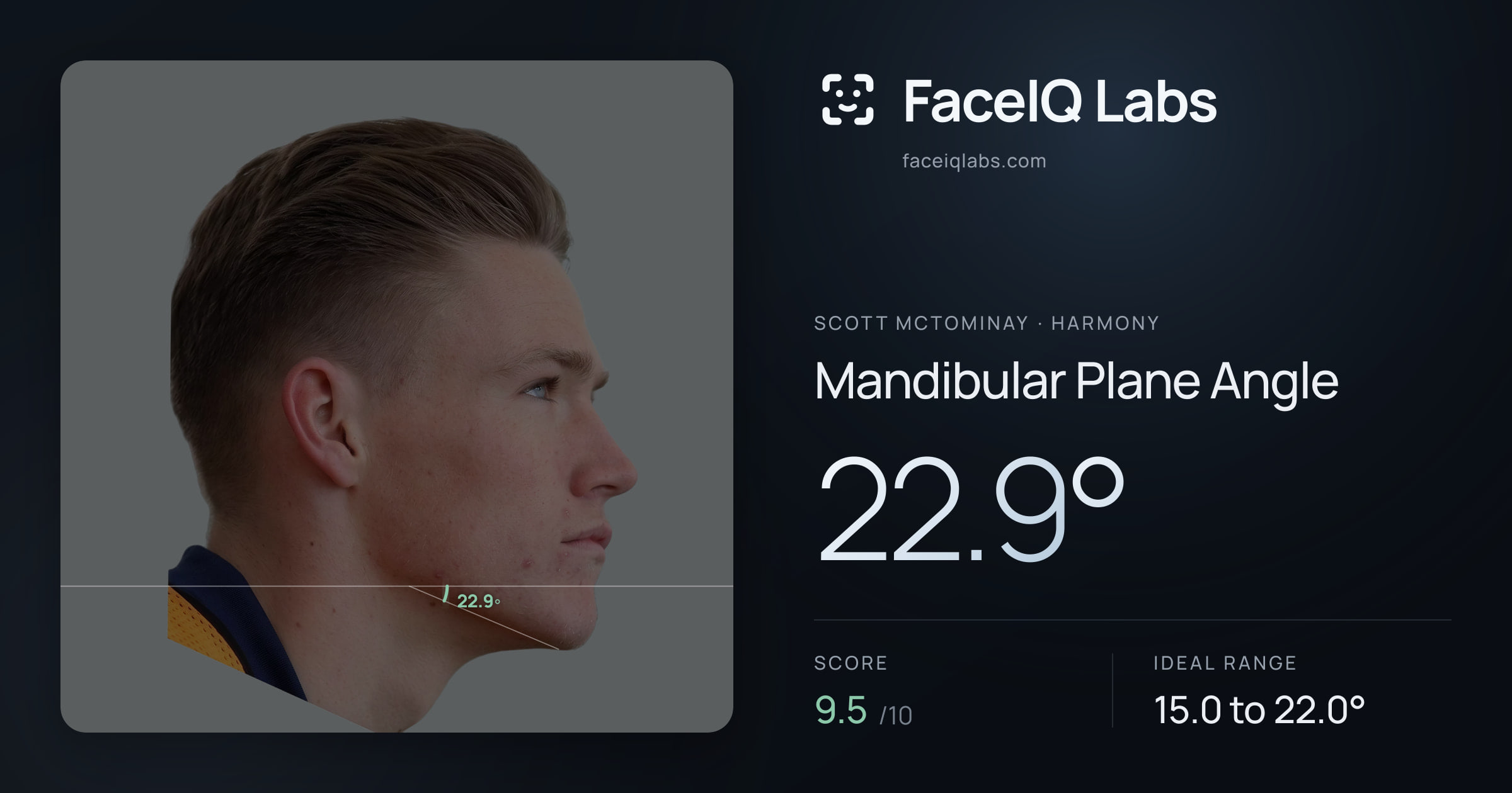 Scott Mctominay Mandibular Plane Angle: 22.9°, drawn on the photo