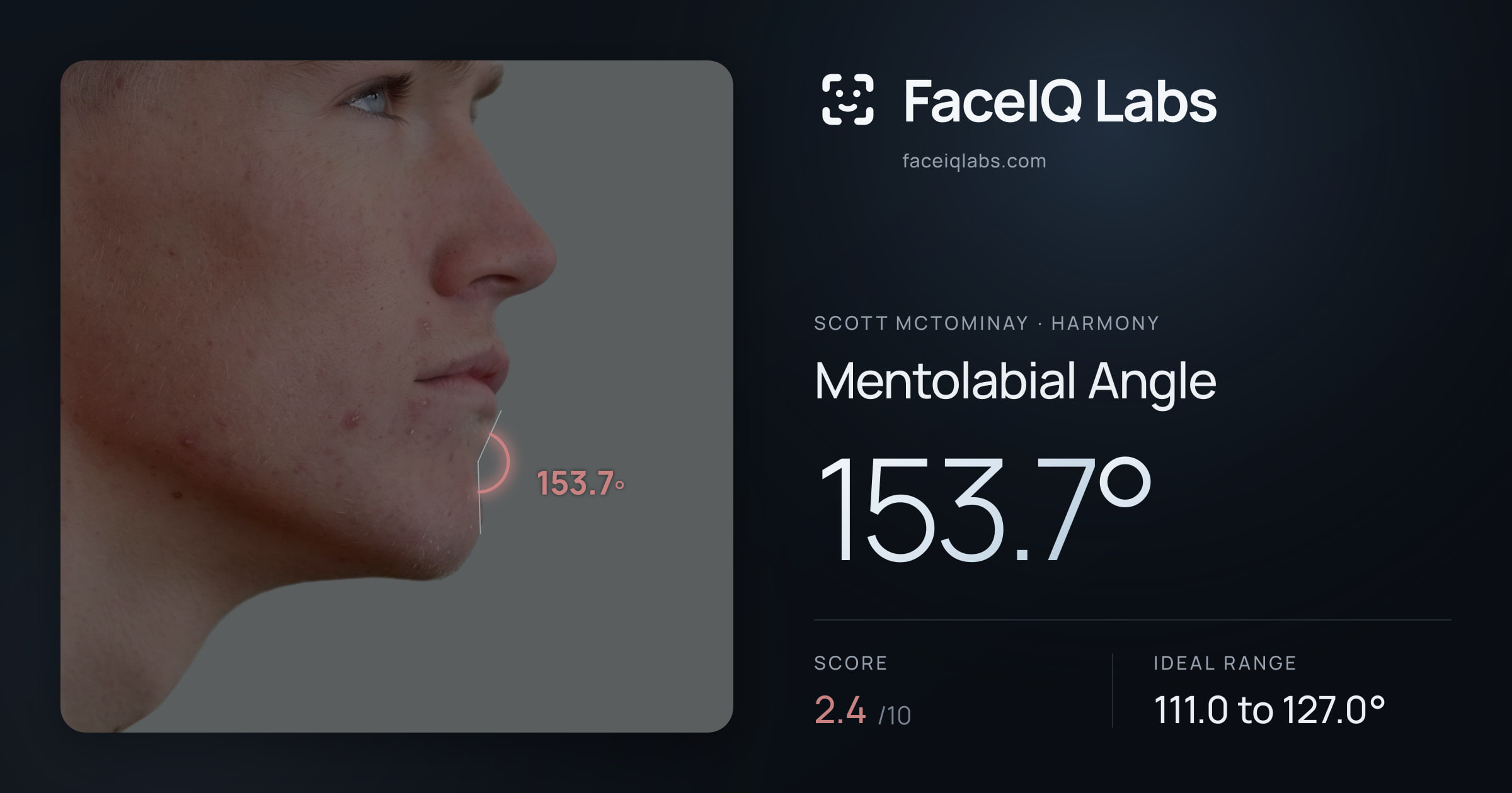 Scott Mctominay Mentolabial Angle: 153.7°, drawn on the photo