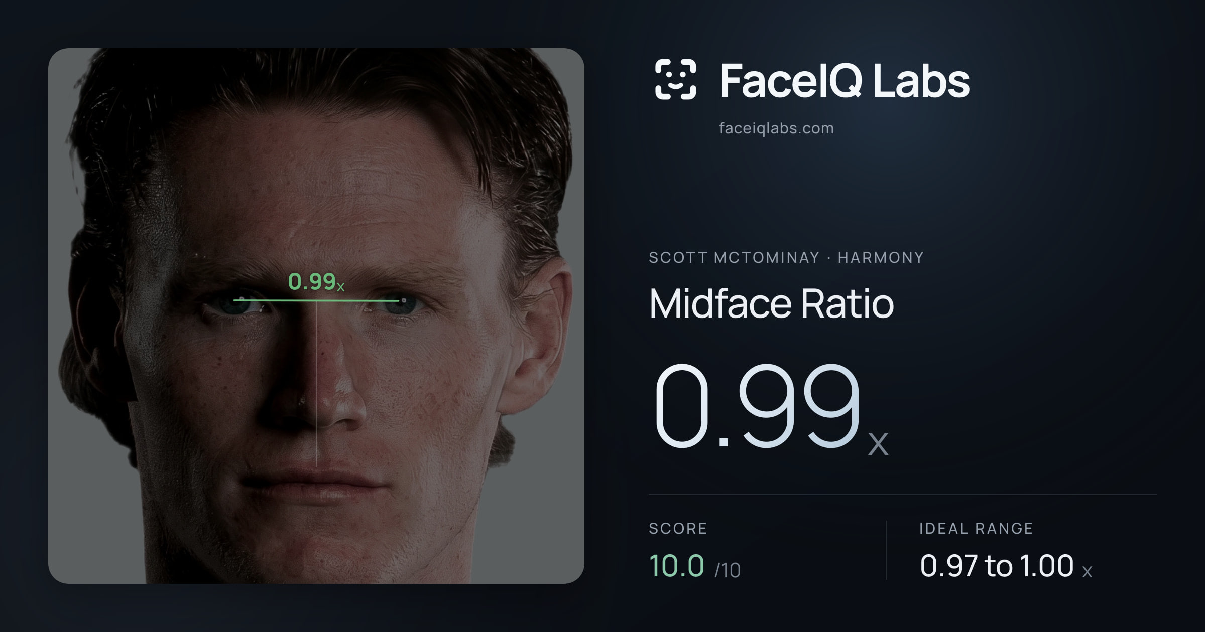 Scott Mctominay Midface Ratio: 0.99x, drawn on the photo