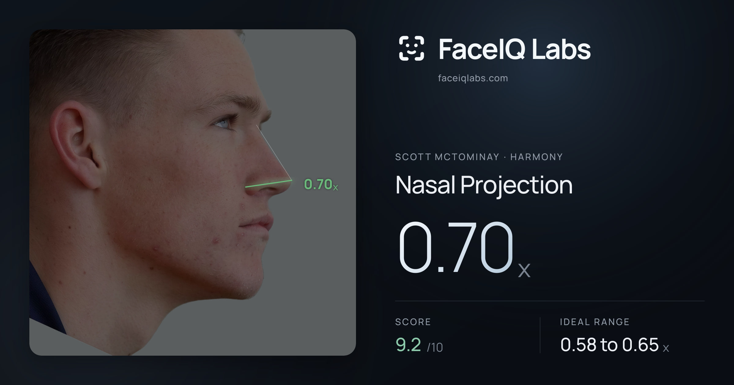 Scott Mctominay Nasal Projection: 0.70x, drawn on the photo