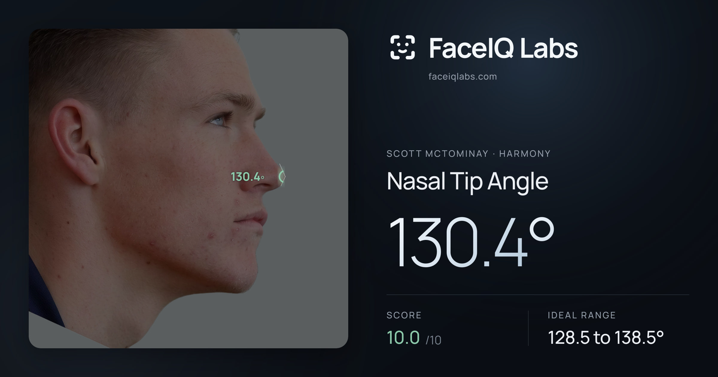 Scott Mctominay Nasal Tip Angle: 130.4°, drawn on the photo