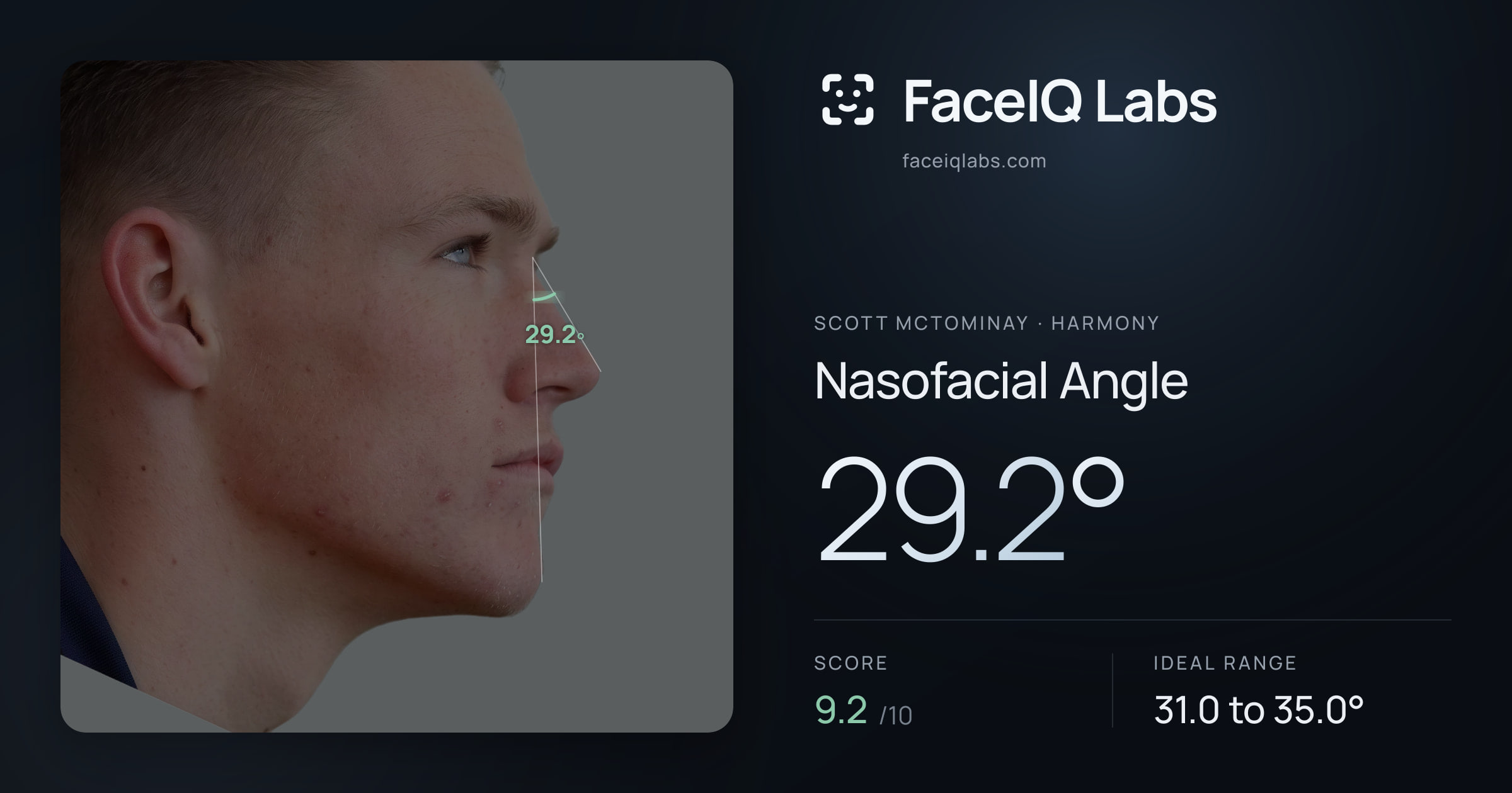 Scott Mctominay Nasofacial Angle: 29.2°, drawn on the photo