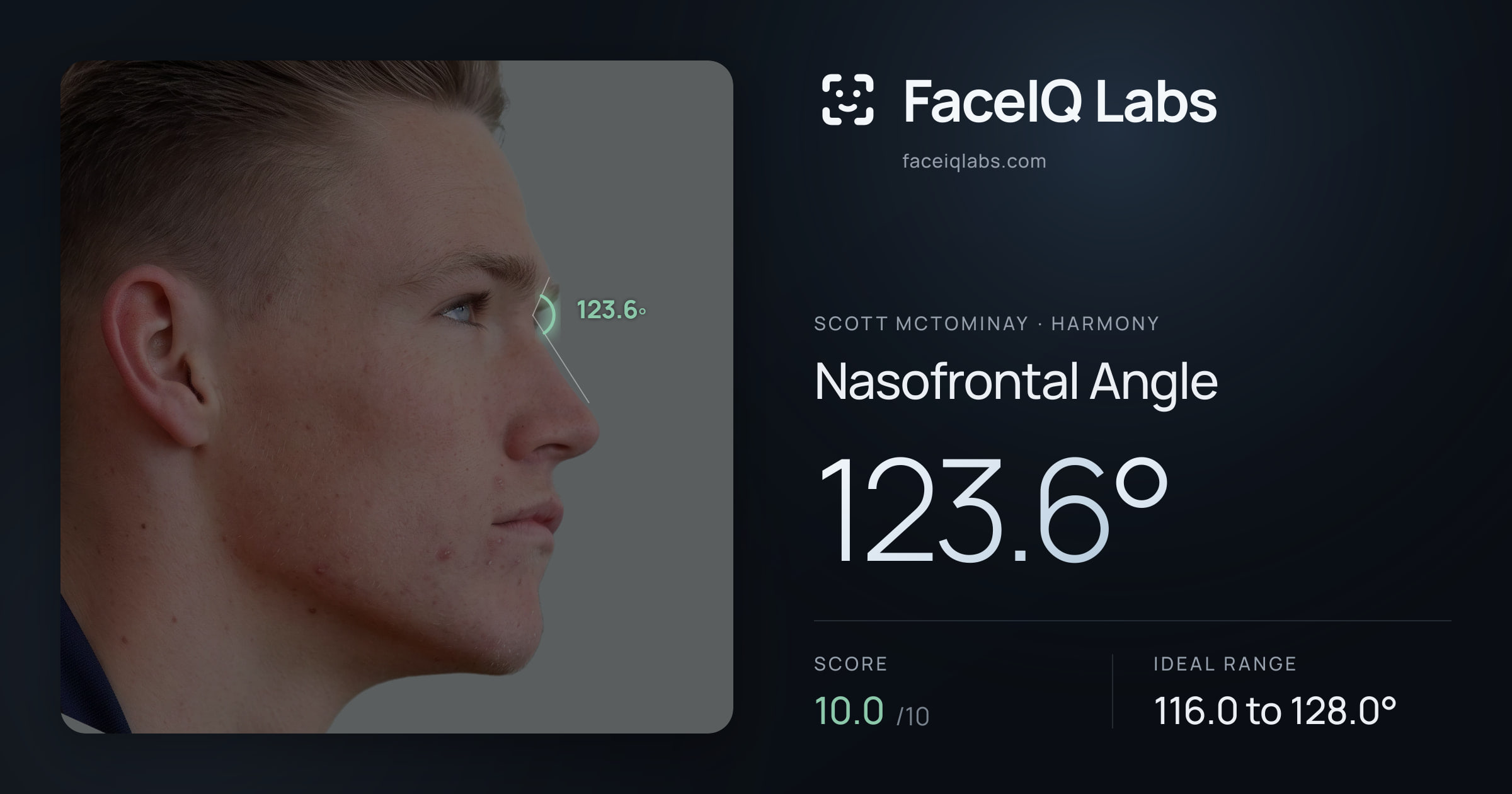 Scott Mctominay Nasofrontal Angle: 123.6°, drawn on the photo