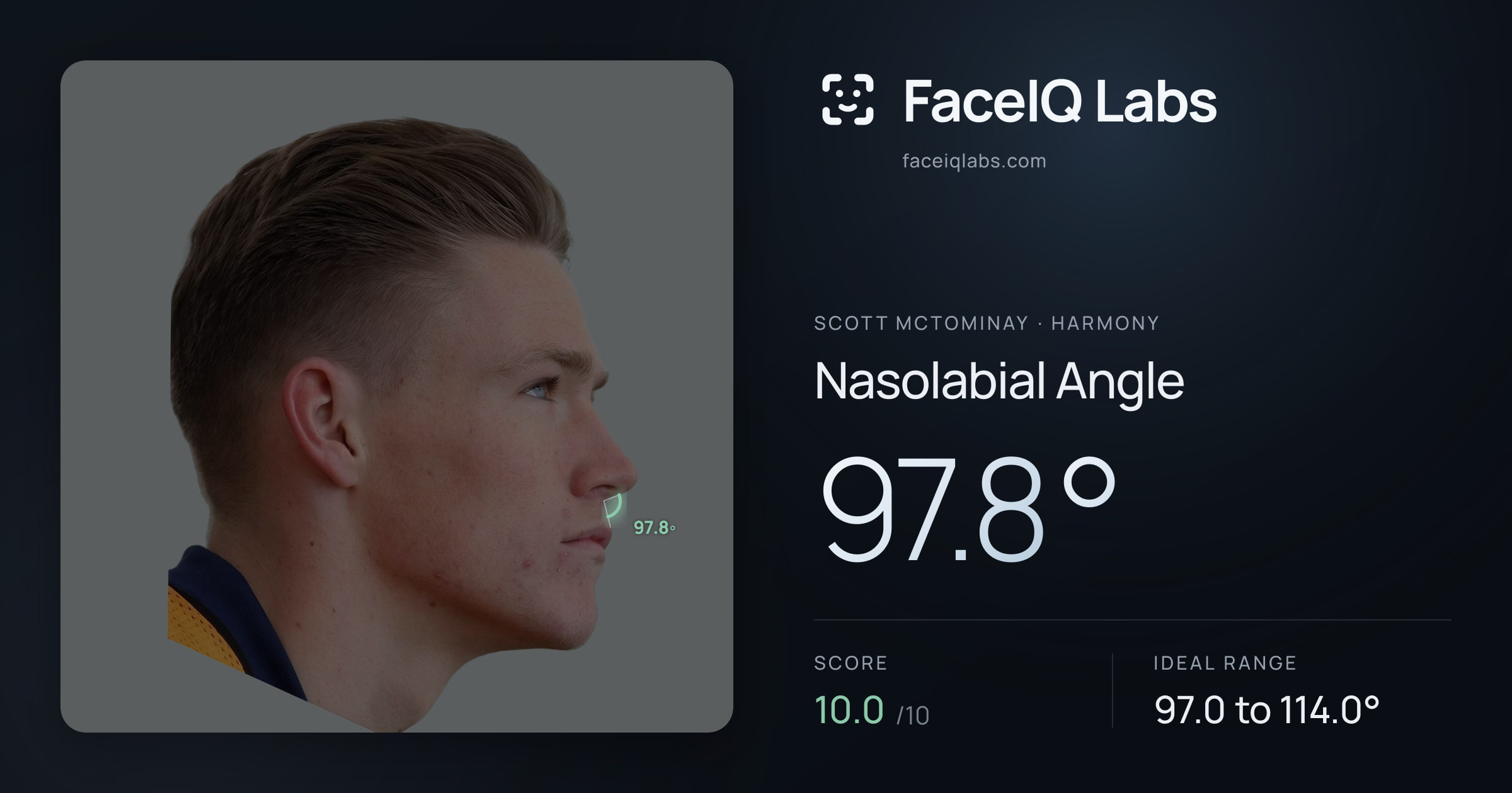 Scott Mctominay Nasolabial Angle: 97.8°, drawn on the photo