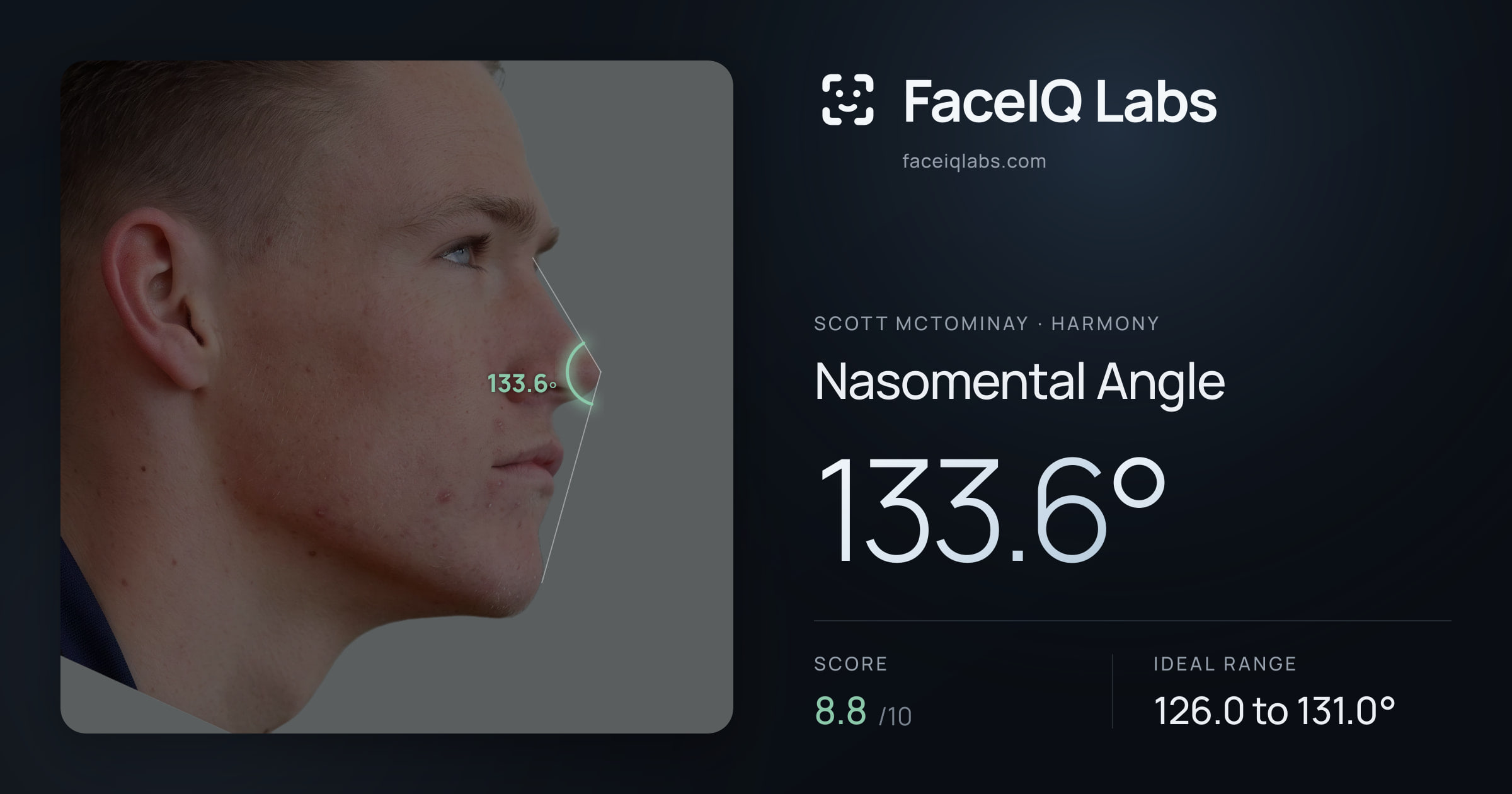 Scott Mctominay Nasomental Angle: 133.6°, drawn on the photo