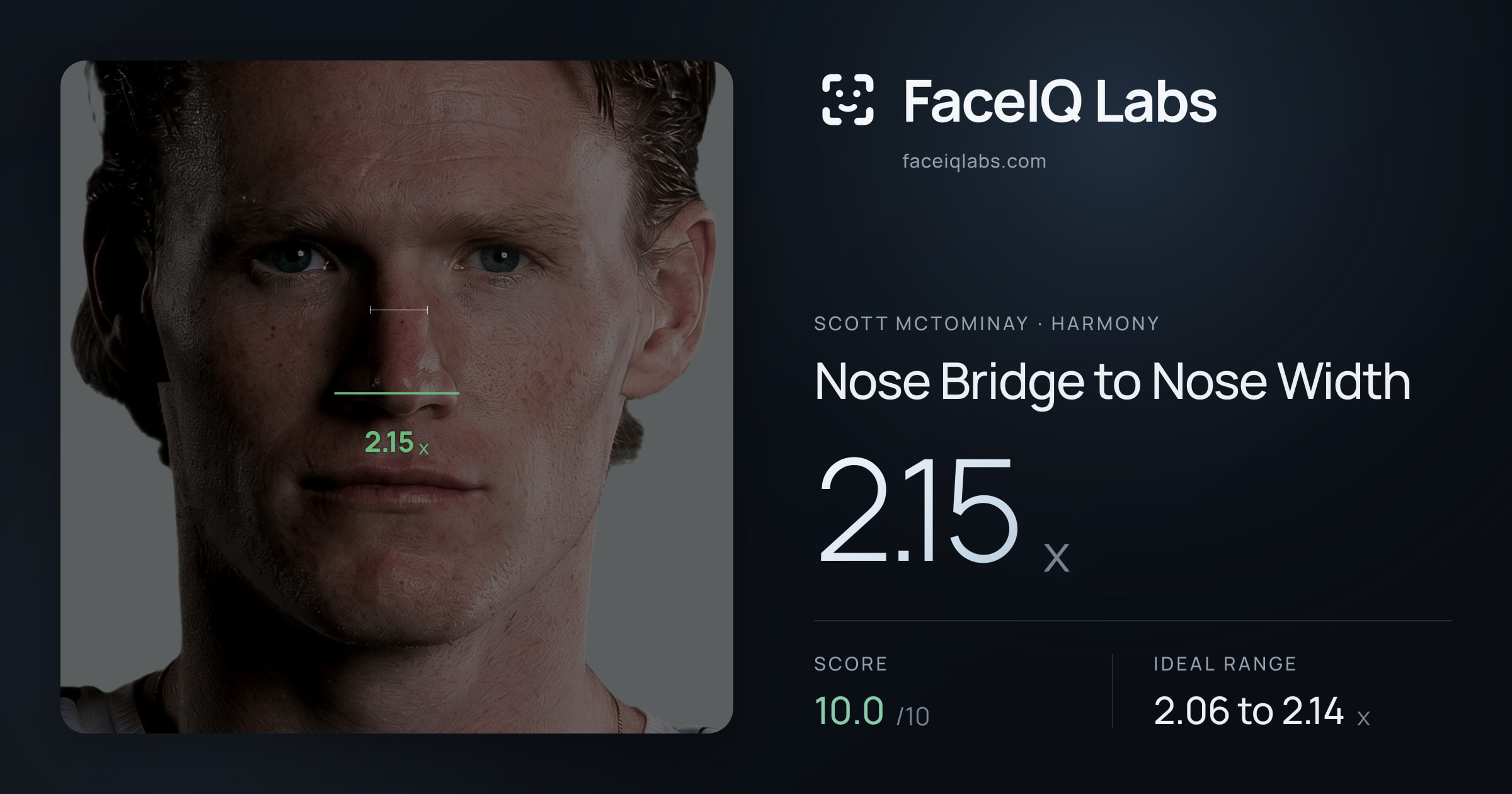 Scott Mctominay Nose Bridge to Nose Width: 2.15x, drawn on the photo