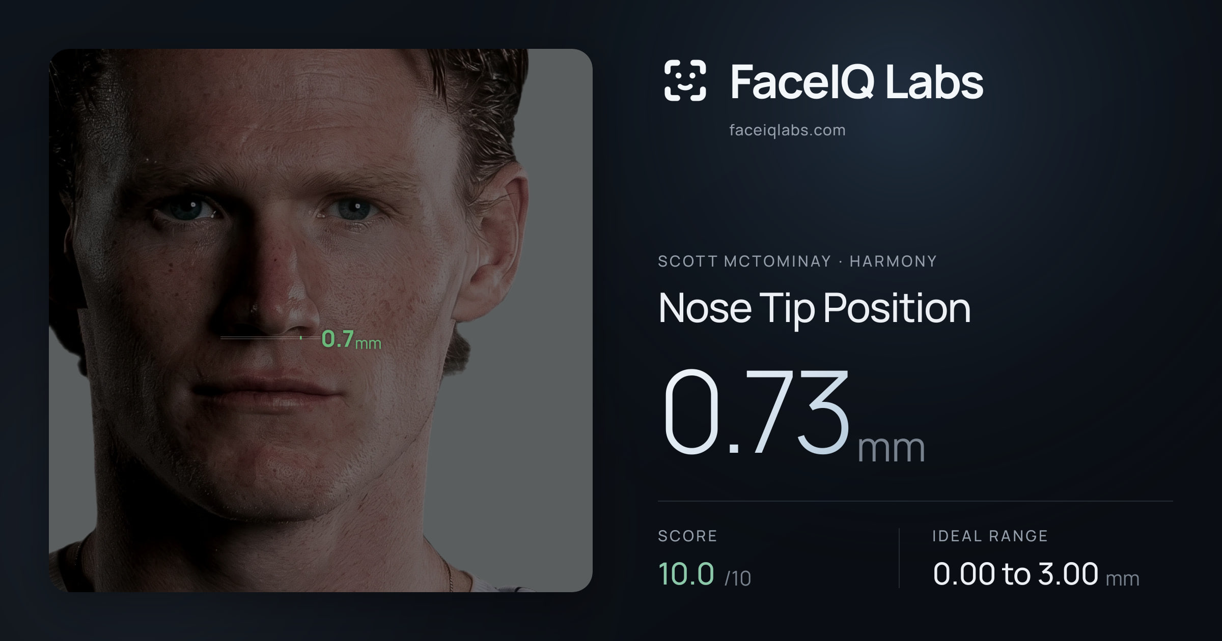Scott Mctominay Nose Tip Position: 0.73mm, drawn on the photo