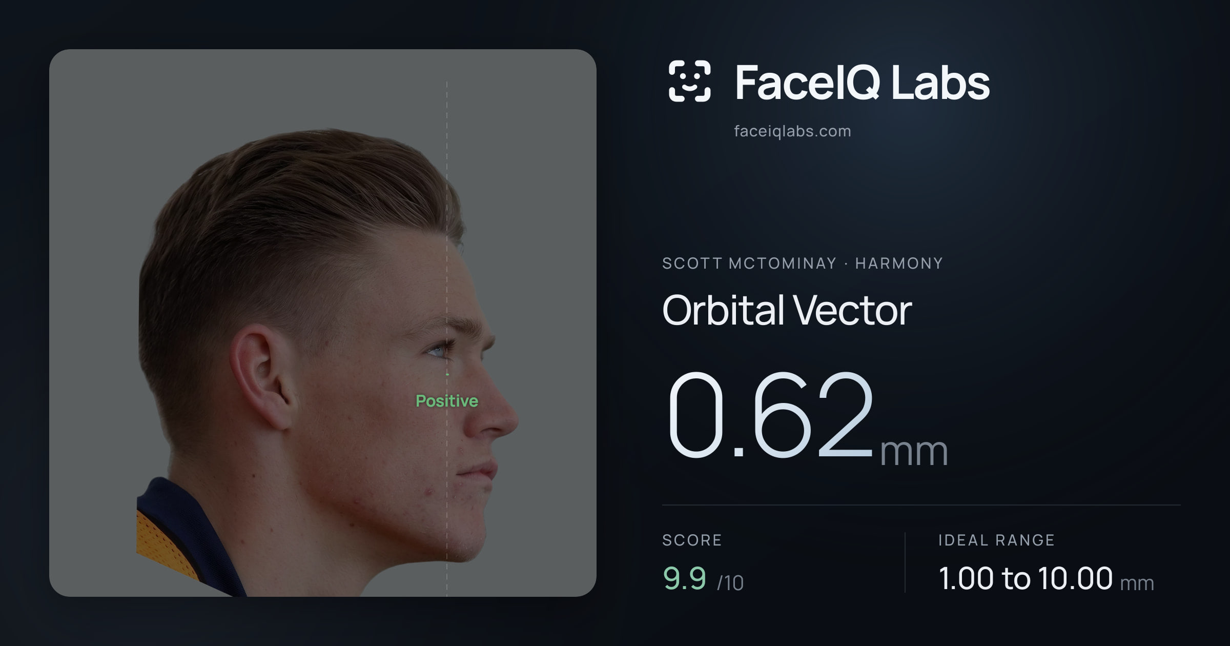 Scott Mctominay Orbital Vector: 0.62mm, drawn on the photo