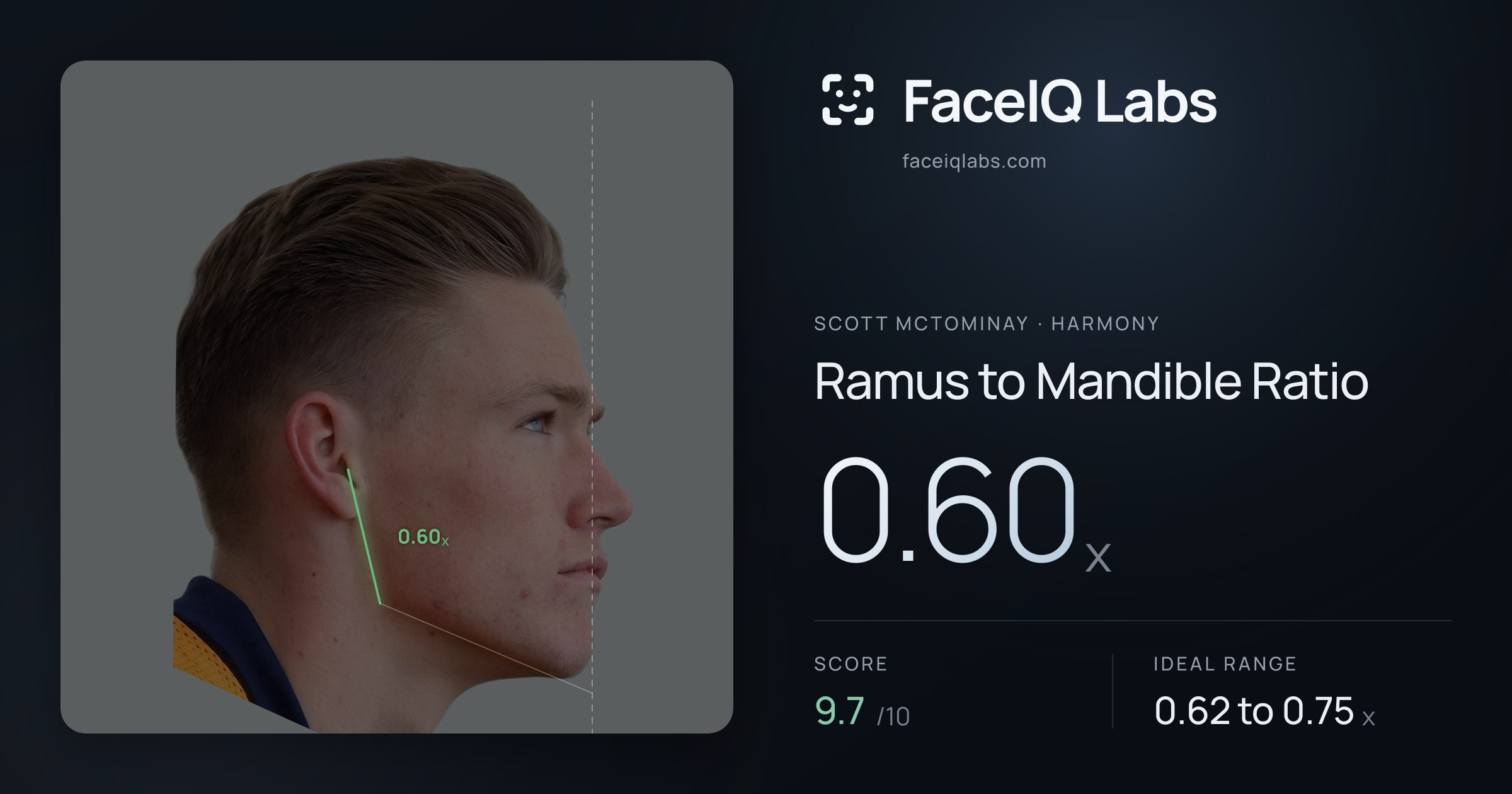 Scott Mctominay Ramus to Mandible Ratio: 0.60x, drawn on the photo