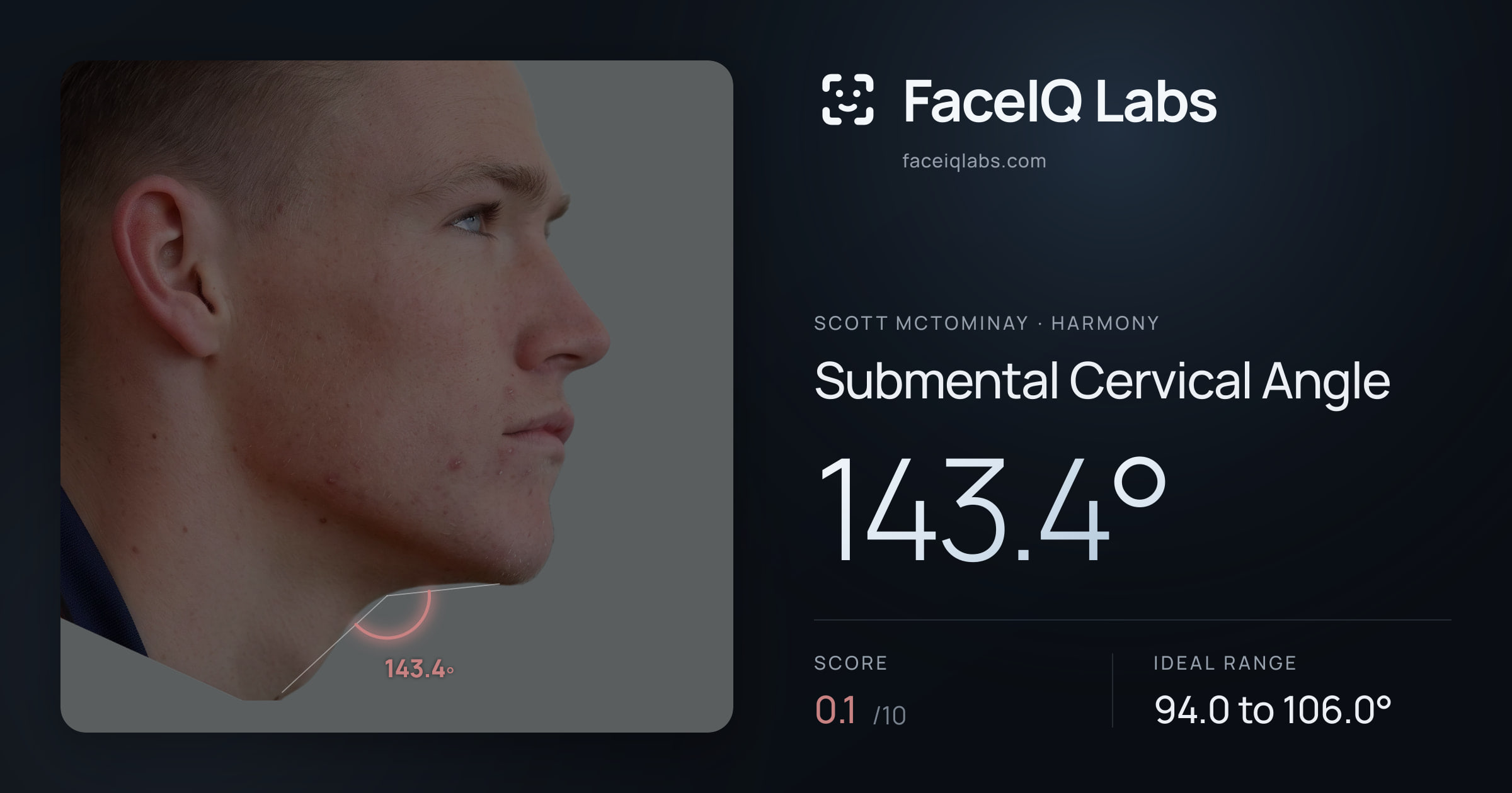 Scott Mctominay Submental Cervical Angle: 143.4°, drawn on the photo