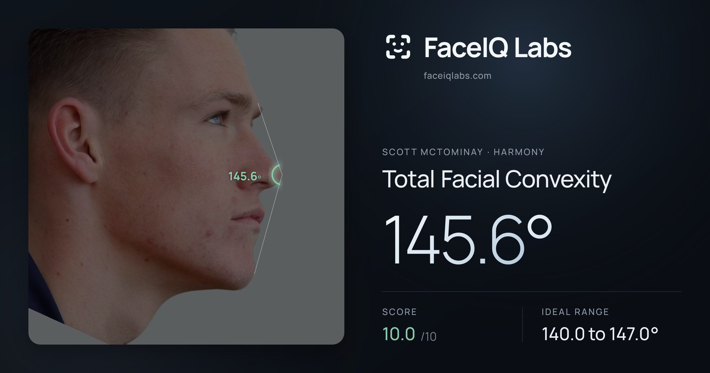 Scott Mctominay Total Facial Convexity: 145.6°, drawn on the photo