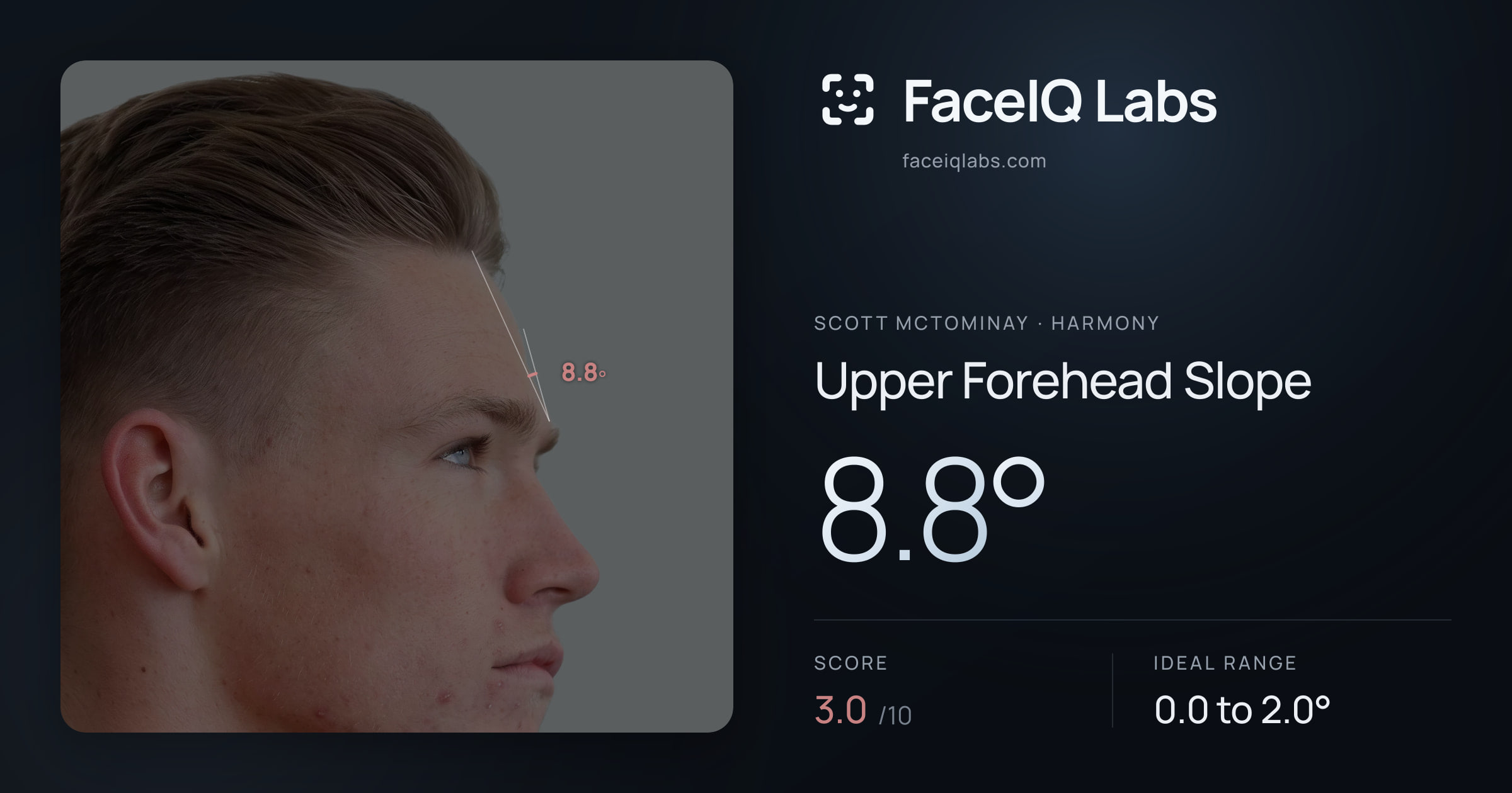 Scott Mctominay Upper Forehead Slope: 8.8°, drawn on the photo