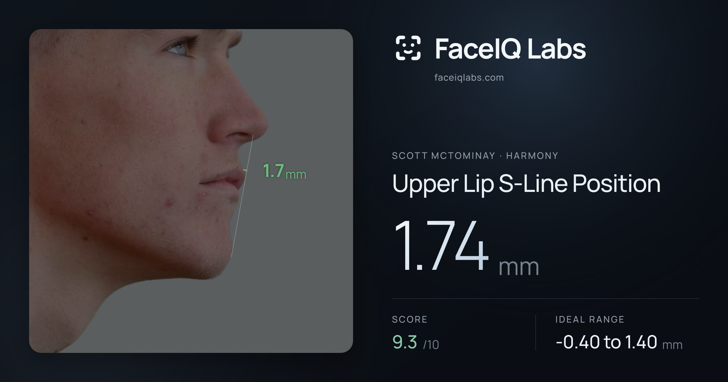 Scott Mctominay Upper Lip S-Line Position: 1.74mm, drawn on the photo