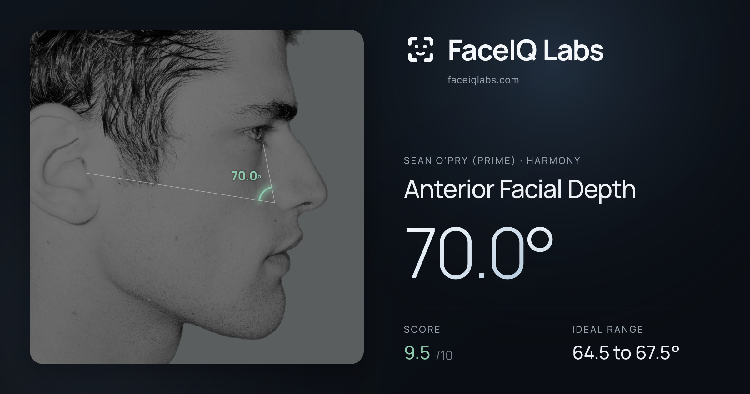 Sean O'Pry (Prime) Anterior Facial Depth: 70.0°, drawn on the photo