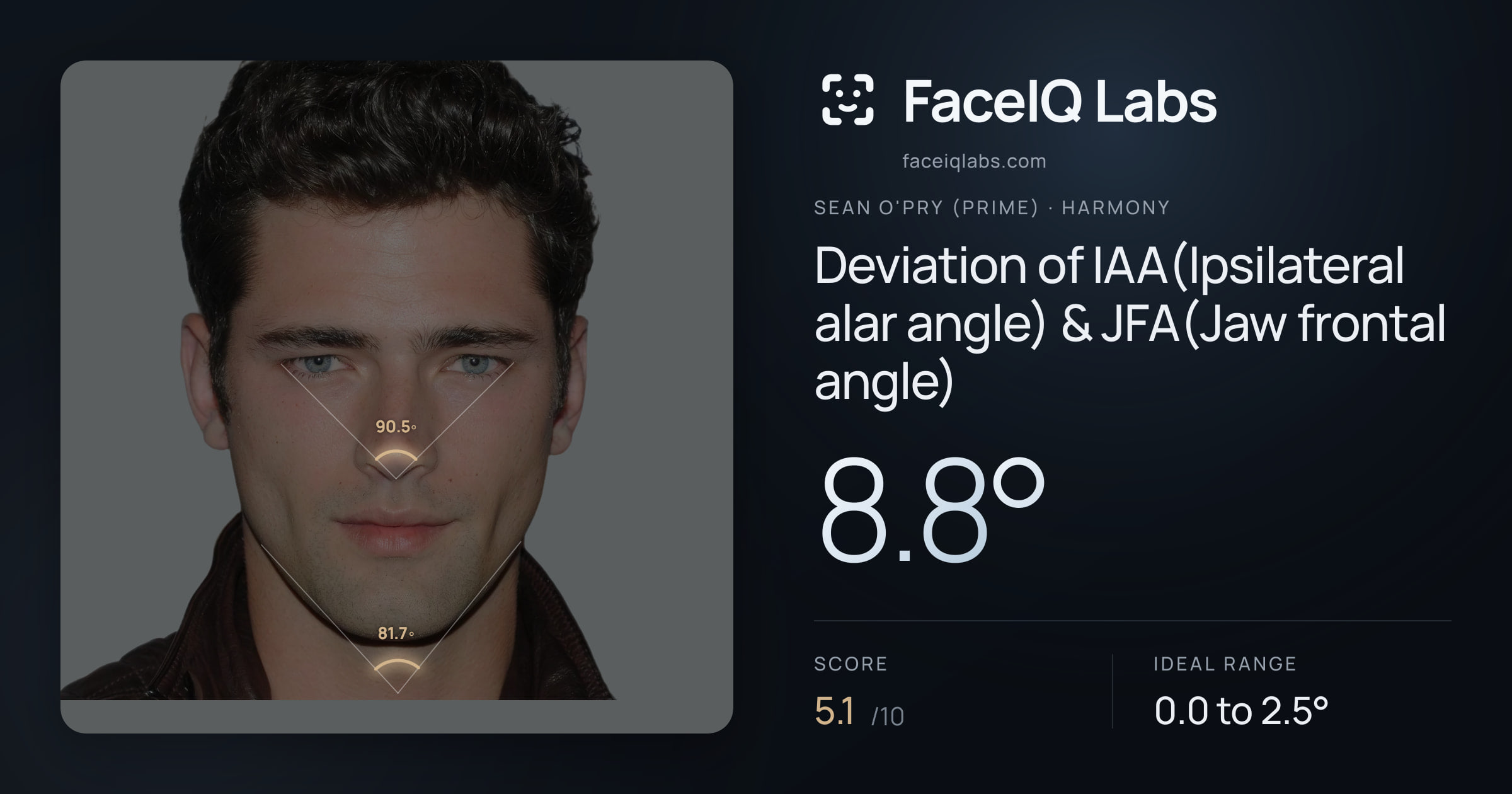 Sean O'Pry (Prime) Deviation of IAA(Ipsilateral alar angle) & JFA(Jaw frontal angle): 8.8°, drawn on the photo