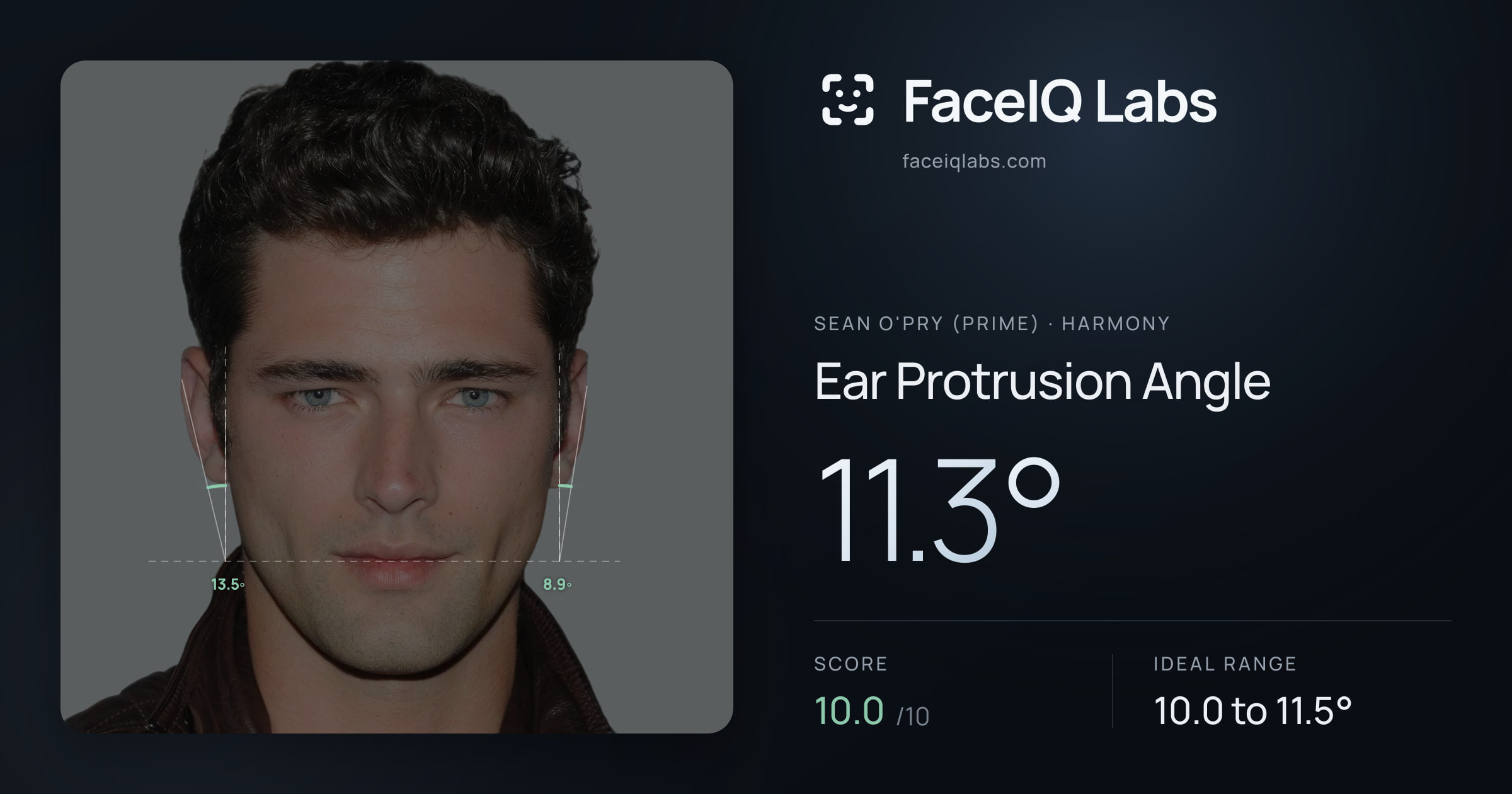 Sean O'Pry (Prime) Ear Protrusion Angle: 11.3°, drawn on the photo