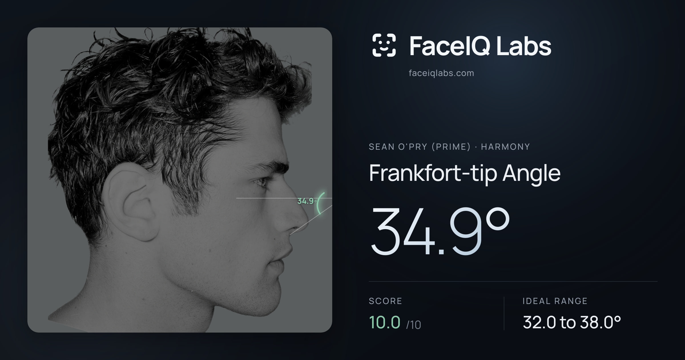 Sean O'Pry (Prime) Frankfort-tip Angle: 34.9°, drawn on the photo