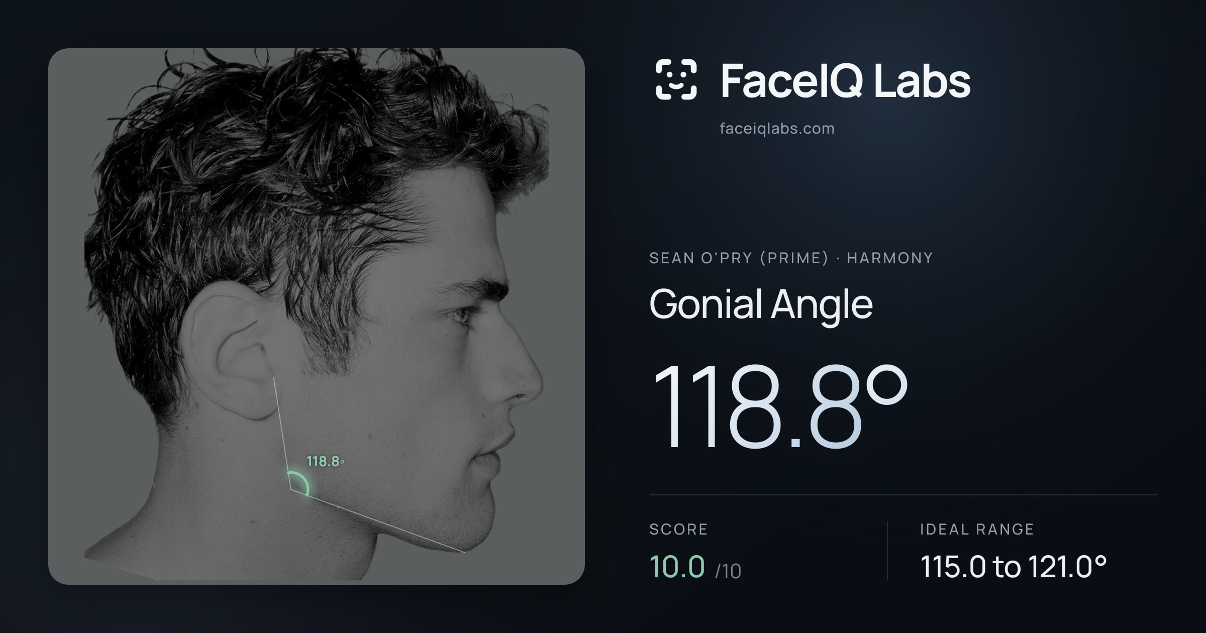 Sean O'Pry (Prime) Gonial Angle: 118.8°, drawn on the photo