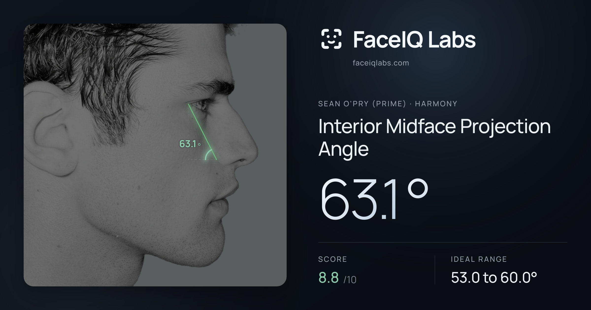Sean O'Pry (Prime) Interior Midface Projection Angle: 63.1°, drawn on the photo