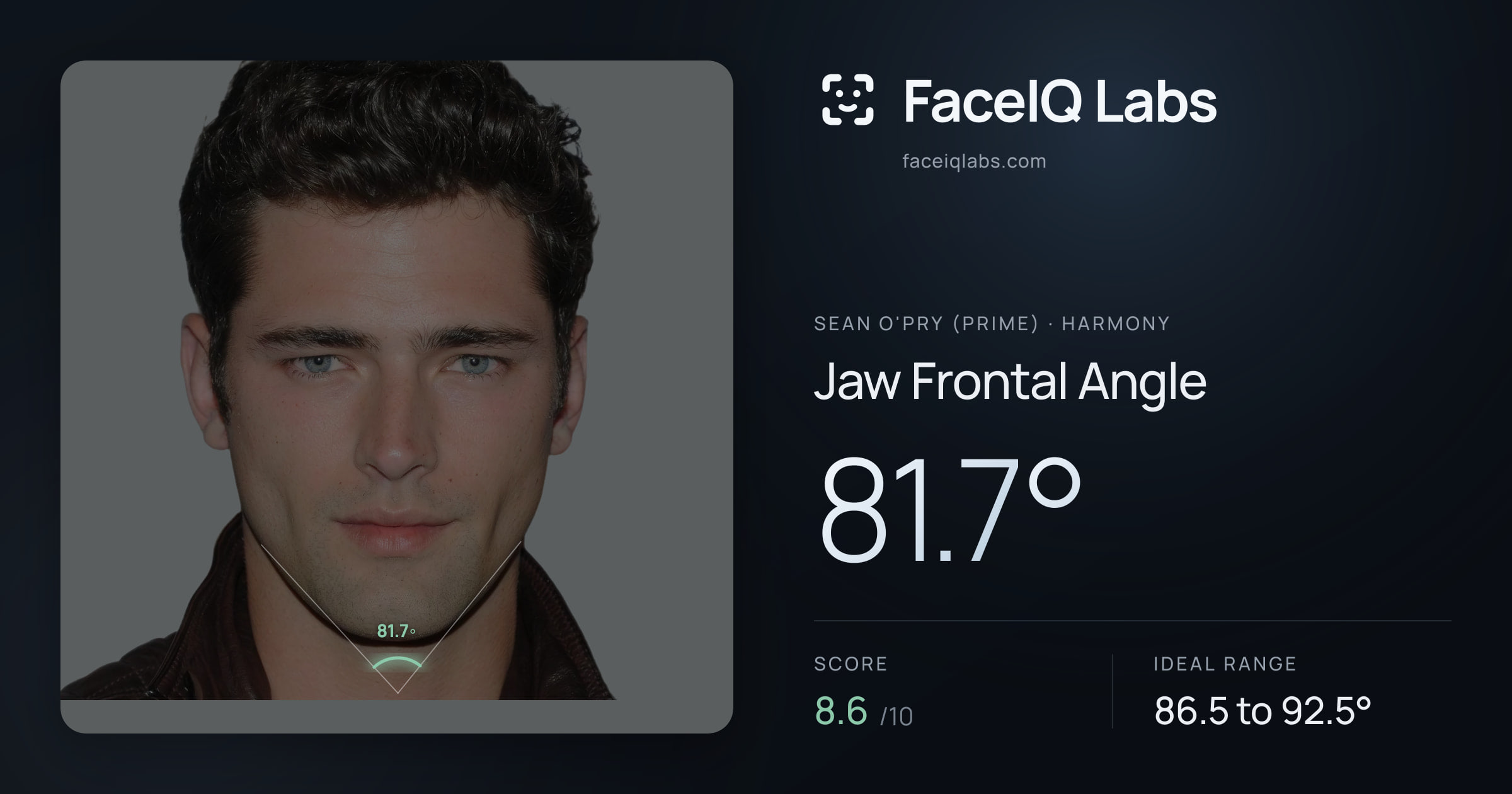 Sean O'Pry (Prime) Jaw Frontal Angle: 81.7°, drawn on the photo
