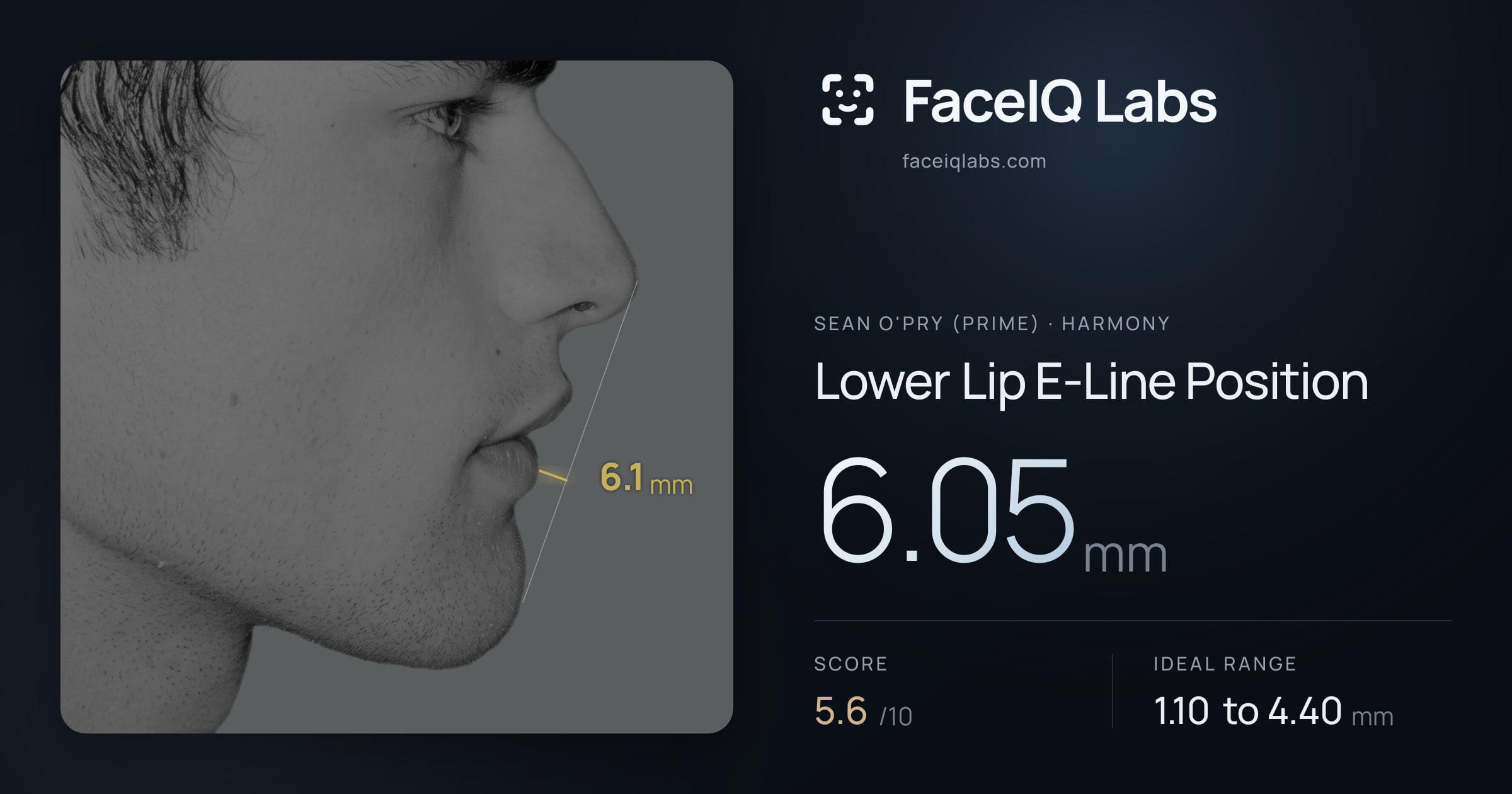 Sean O'Pry (Prime) Lower Lip E-Line Position: 6.05mm, drawn on the photo