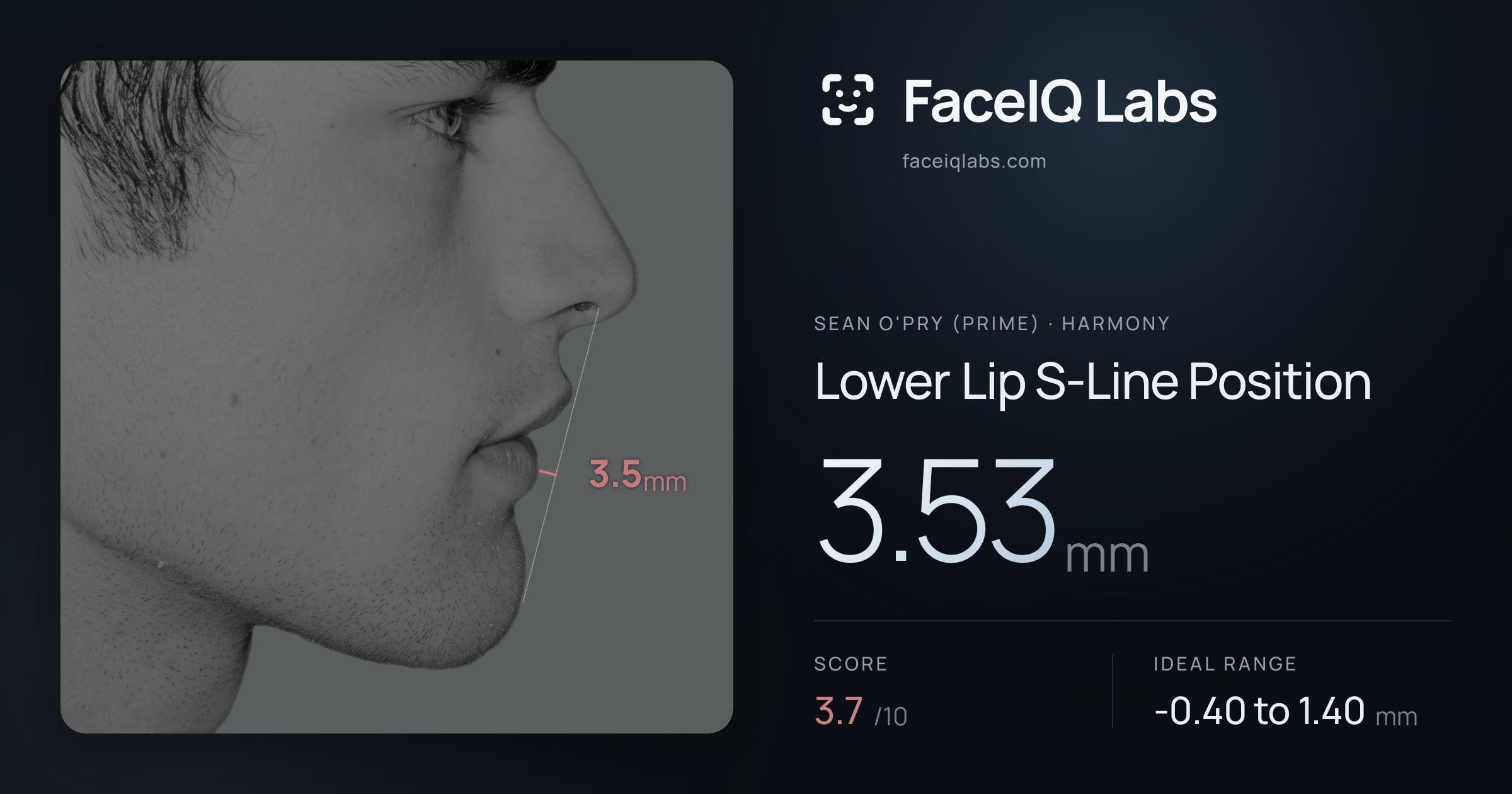 Sean O'Pry (Prime) Lower Lip S-Line Position: 3.53mm, drawn on the photo