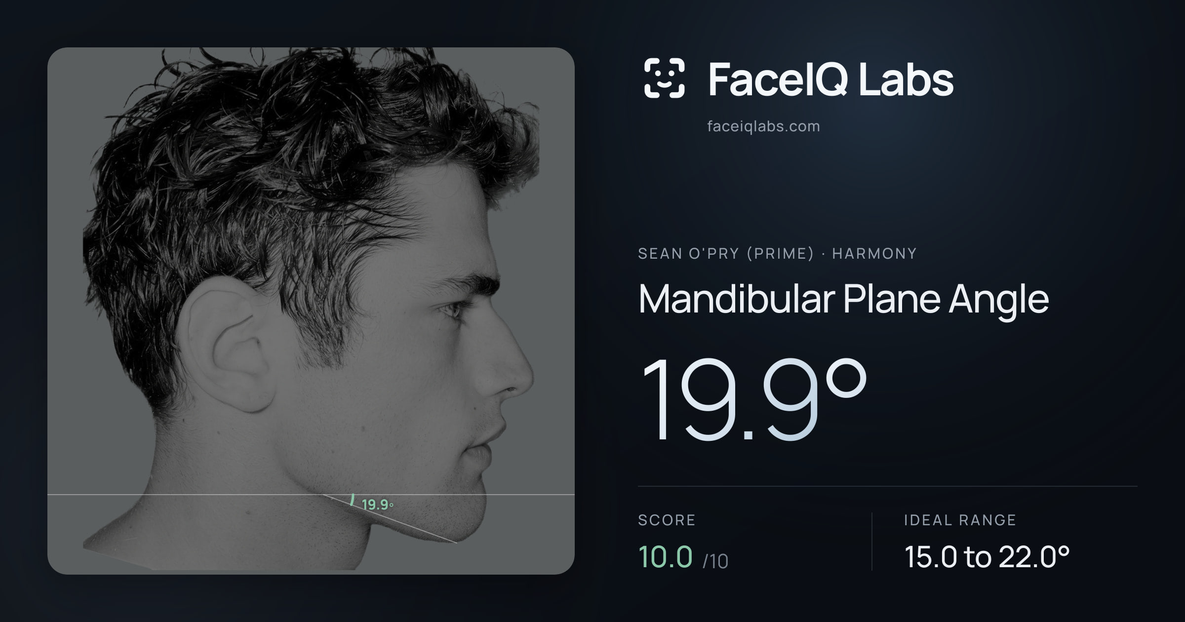 Sean O'Pry (Prime) Mandibular Plane Angle: 19.9°, drawn on the photo