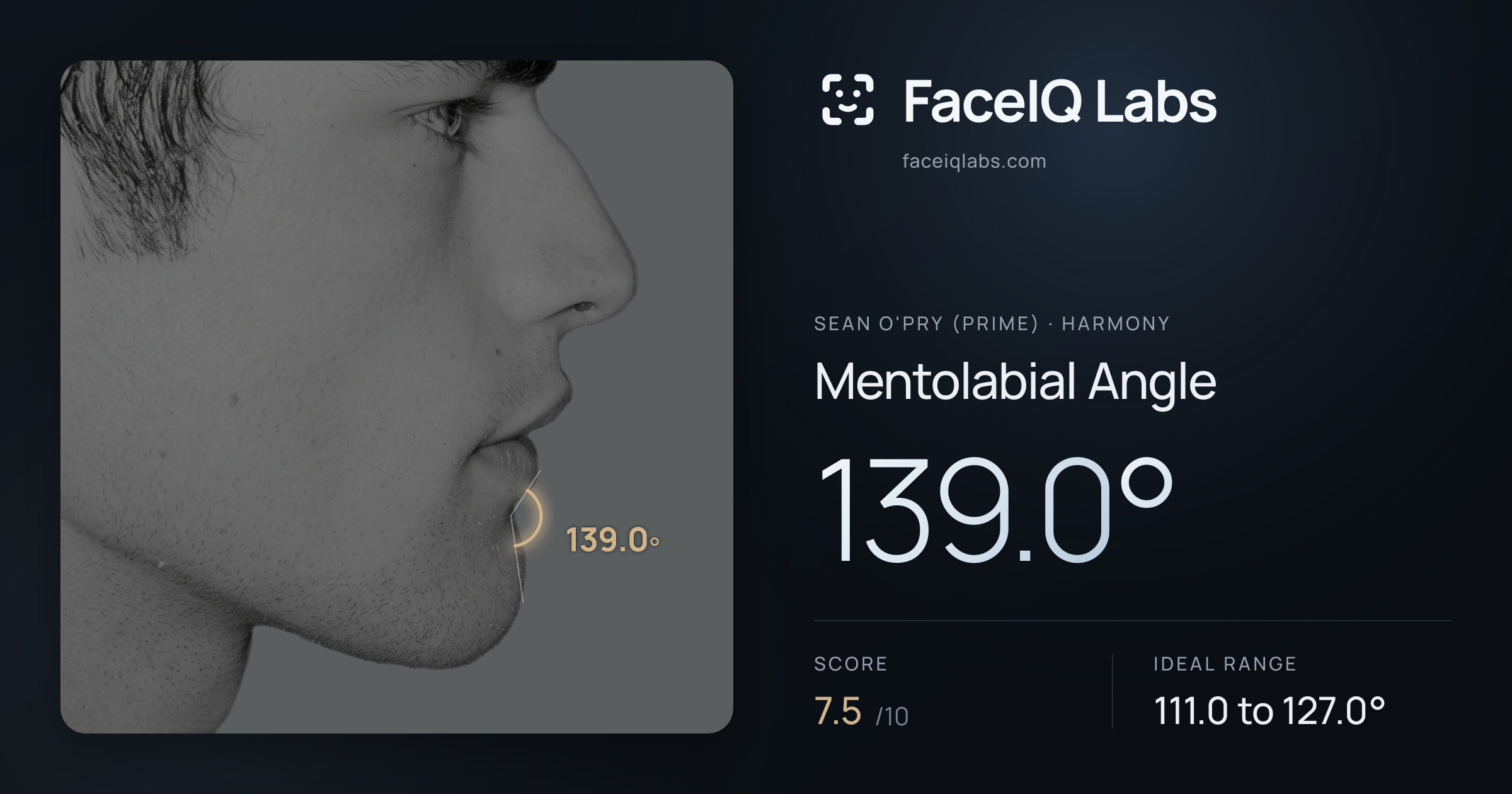 Sean O'Pry (Prime) Mentolabial Angle: 139.0°, drawn on the photo
