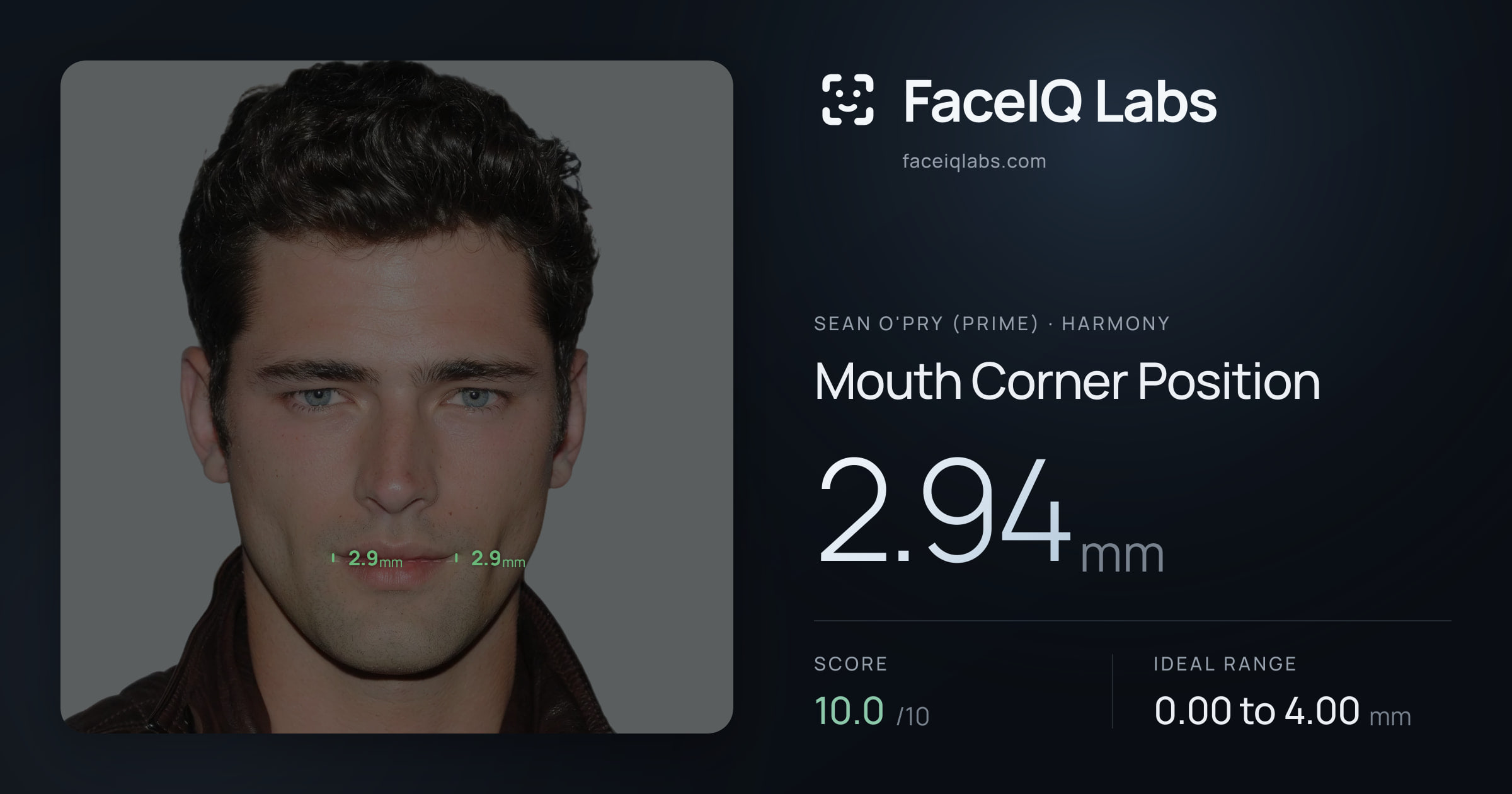 Sean O'Pry (Prime) Mouth Corner Position: 2.94mm, drawn on the photo