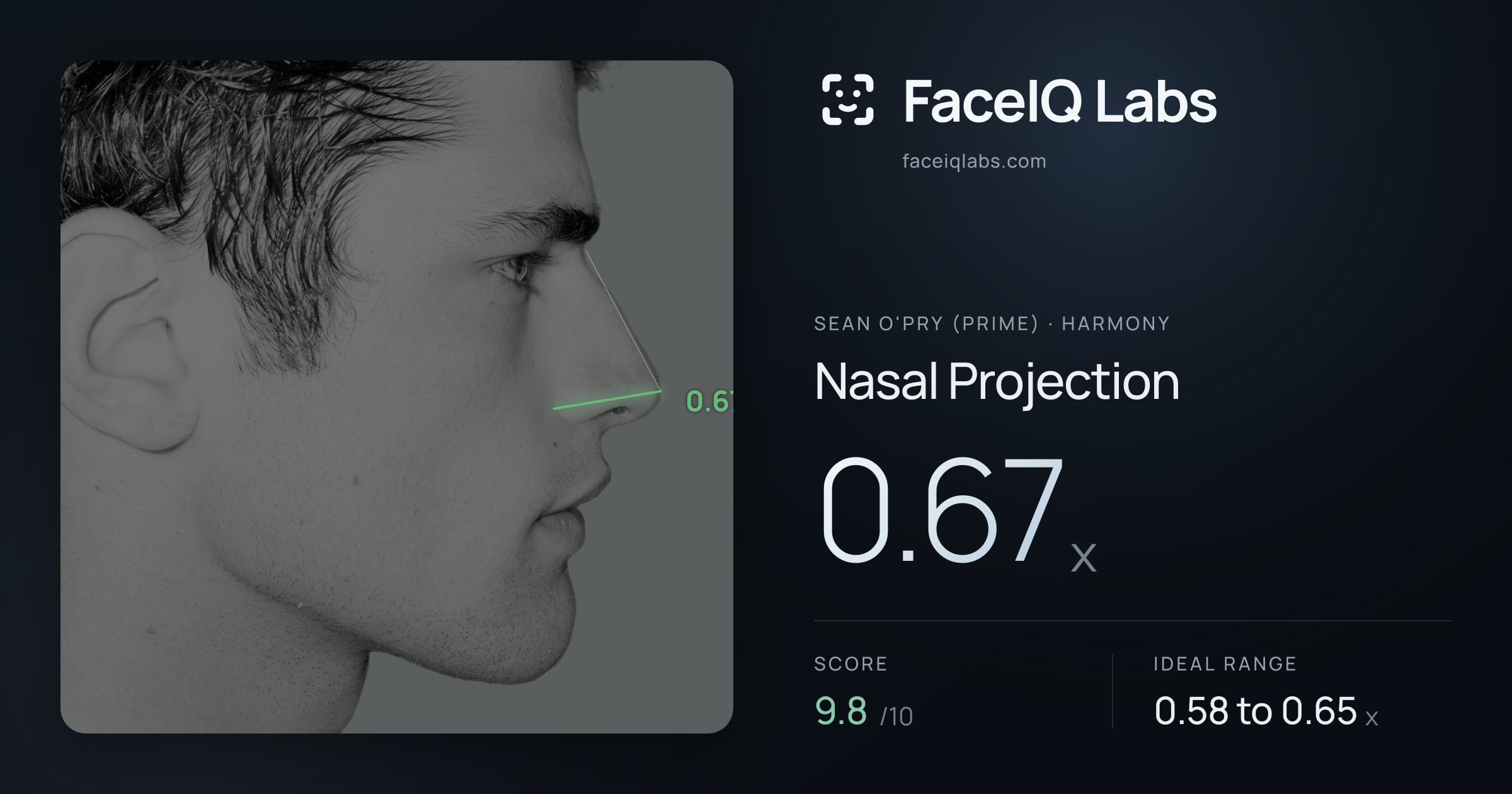 Sean O'Pry (Prime) Nasal Projection: 0.67x, drawn on the photo