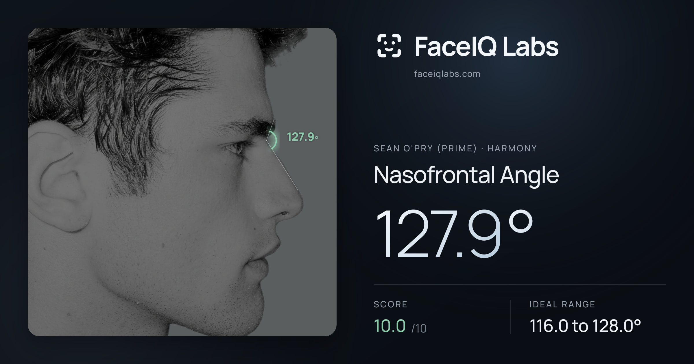 Sean O'Pry (Prime) Nasofrontal Angle: 127.9°, drawn on the photo