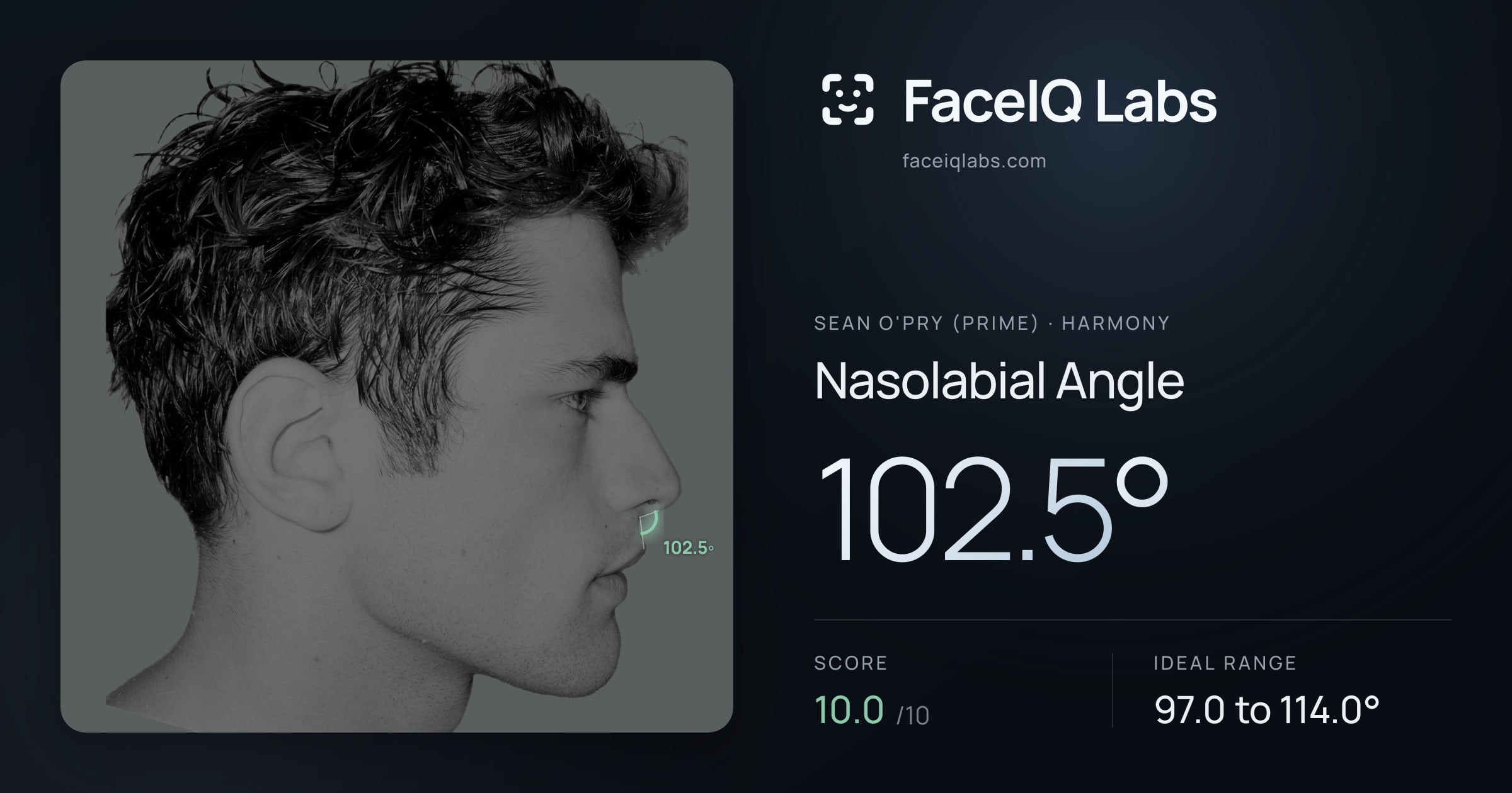 Sean O'Pry (Prime) Nasolabial Angle: 102.5°, drawn on the photo