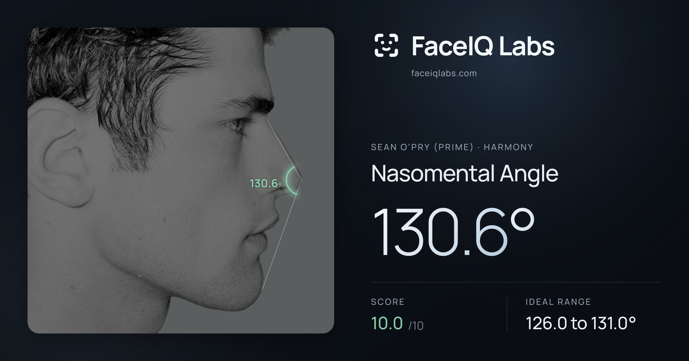 Sean O'Pry (Prime) Nasomental Angle: 130.6°, drawn on the photo
