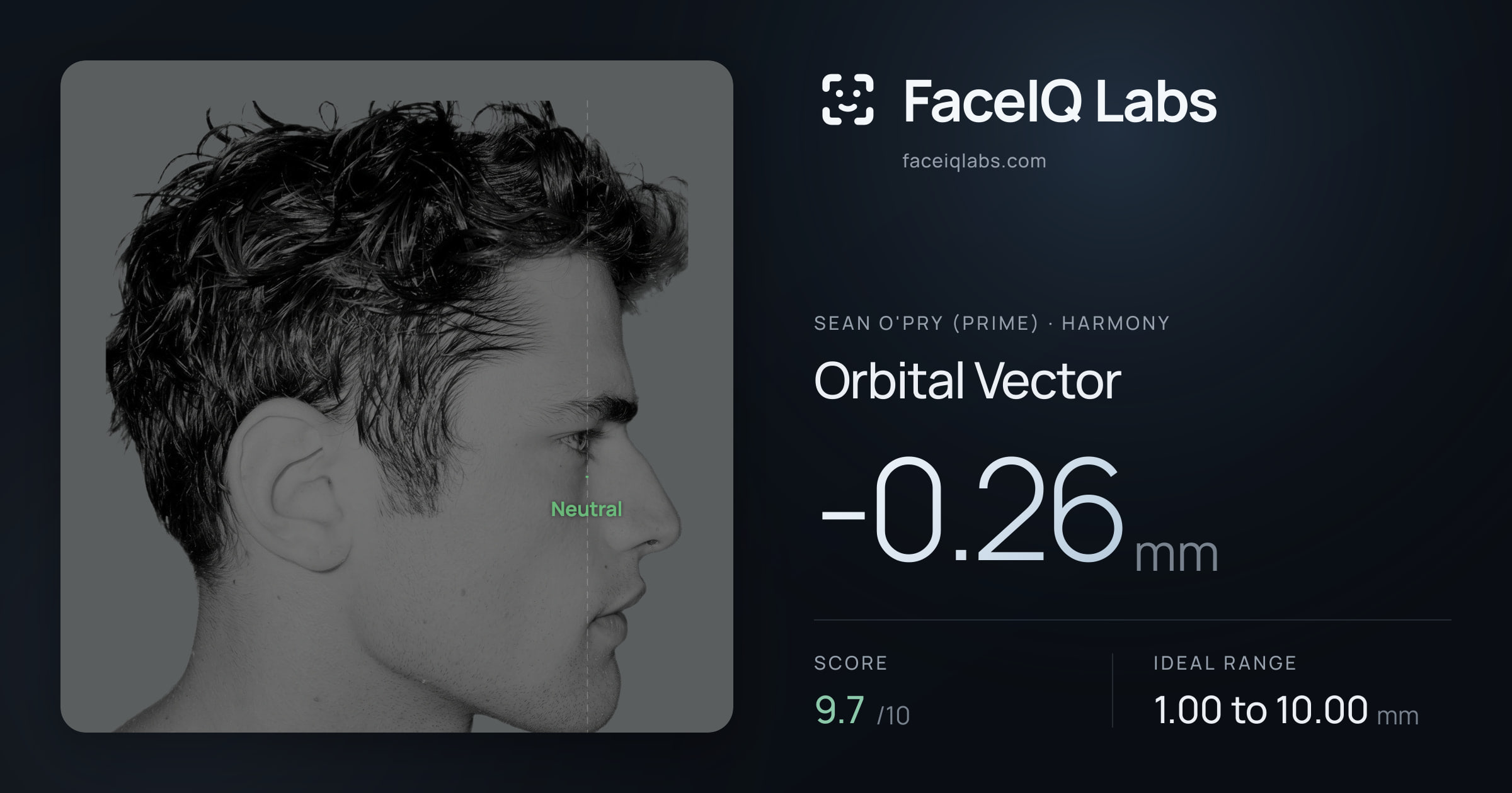 Sean O'Pry (Prime) Orbital Vector: -0.26mm, drawn on the photo