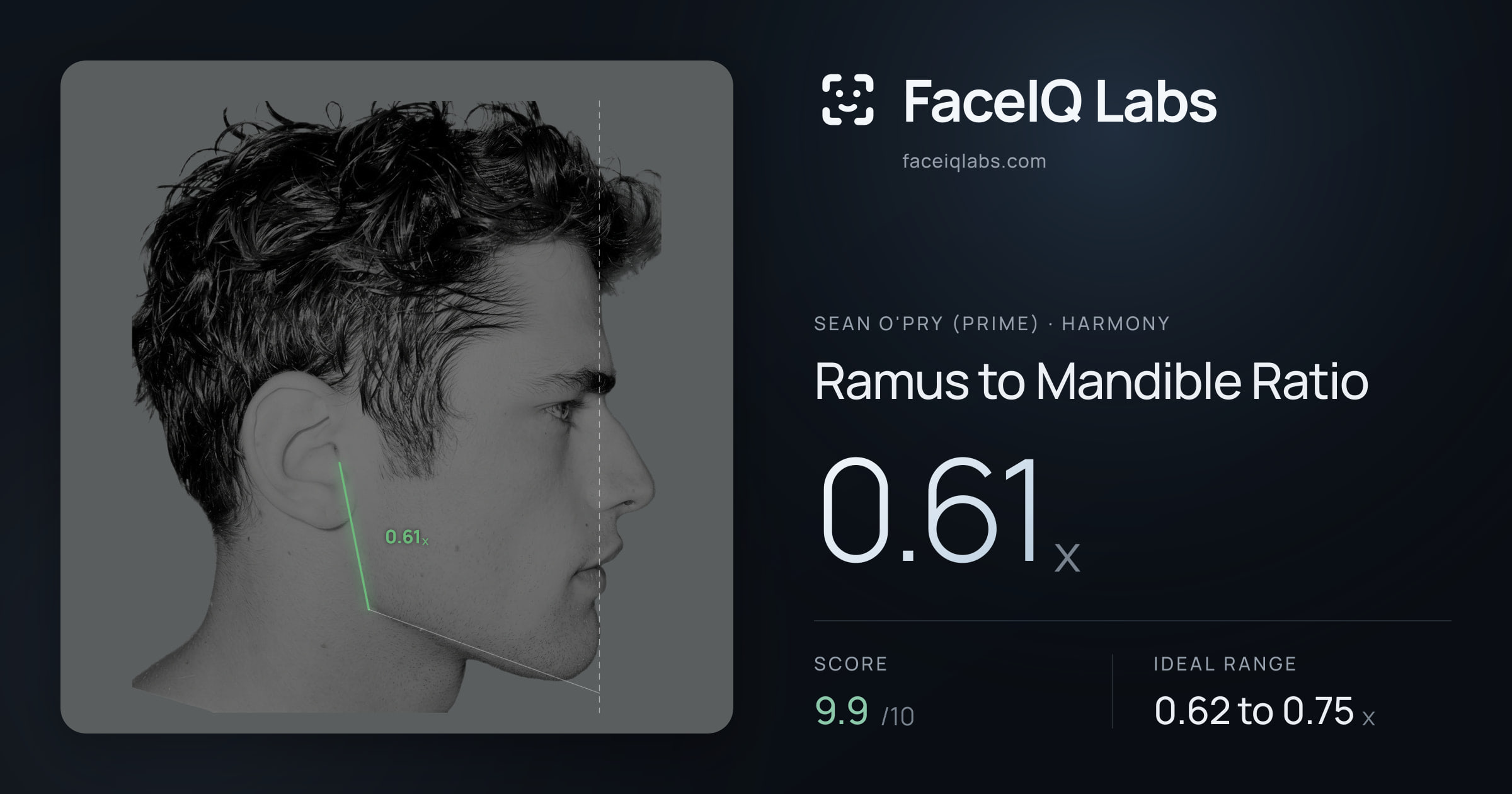 Sean O'Pry (Prime) Ramus to Mandible Ratio: 0.61x, drawn on the photo