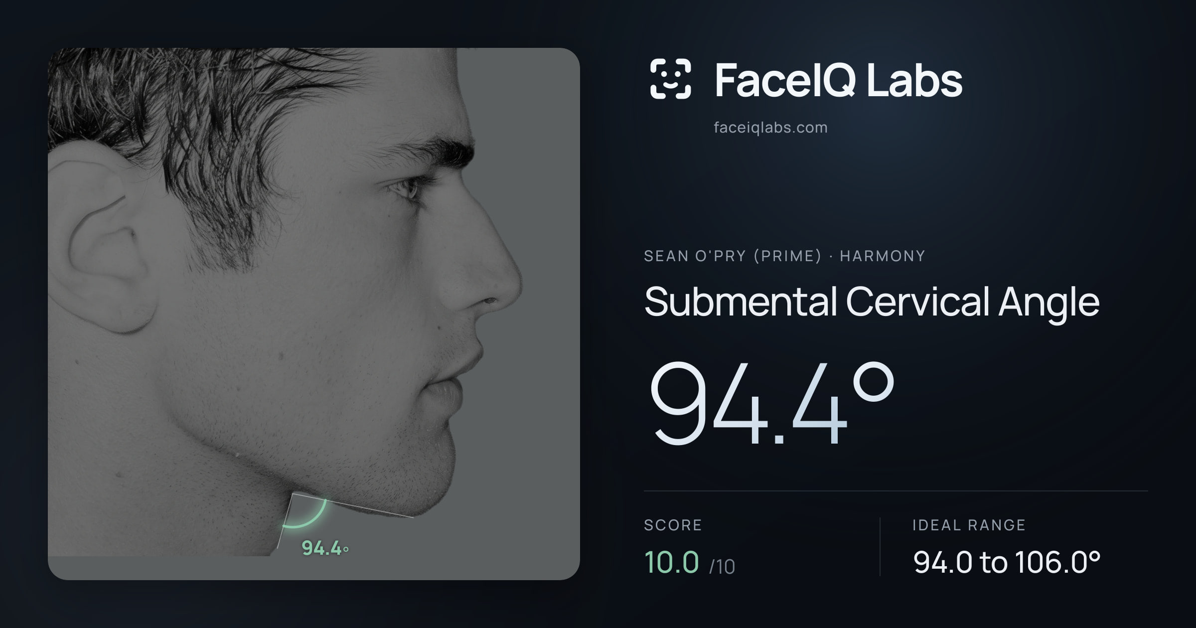 Sean O'Pry (Prime) Submental Cervical Angle: 94.4°, drawn on the photo