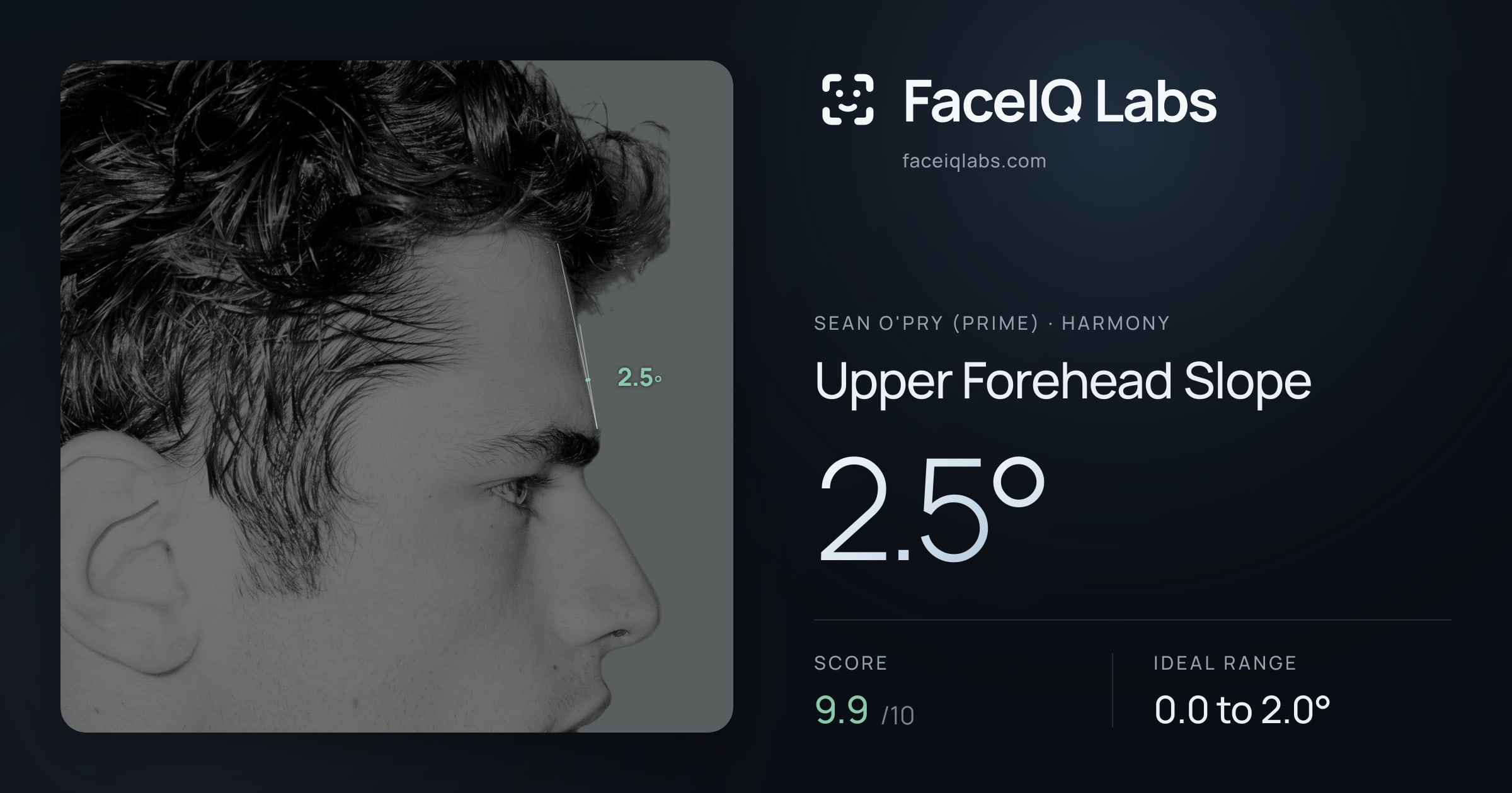 Sean O'Pry (Prime) Upper Forehead Slope: 2.5°, drawn on the photo