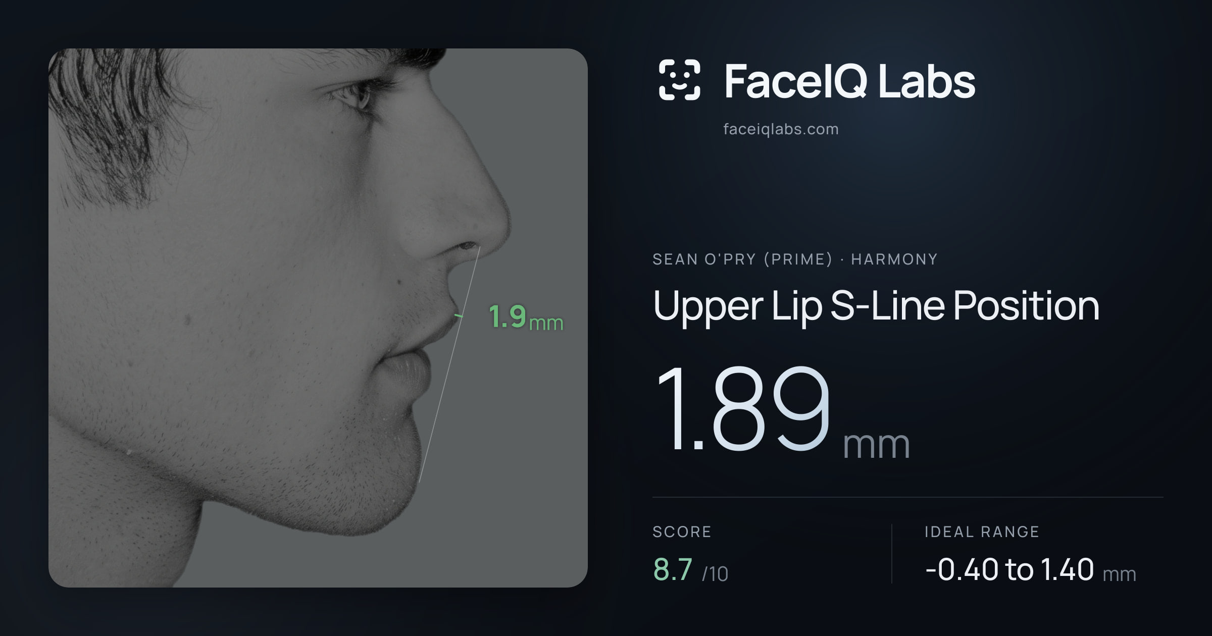 Sean O'Pry (Prime) Upper Lip S-Line Position: 1.89mm, drawn on the photo