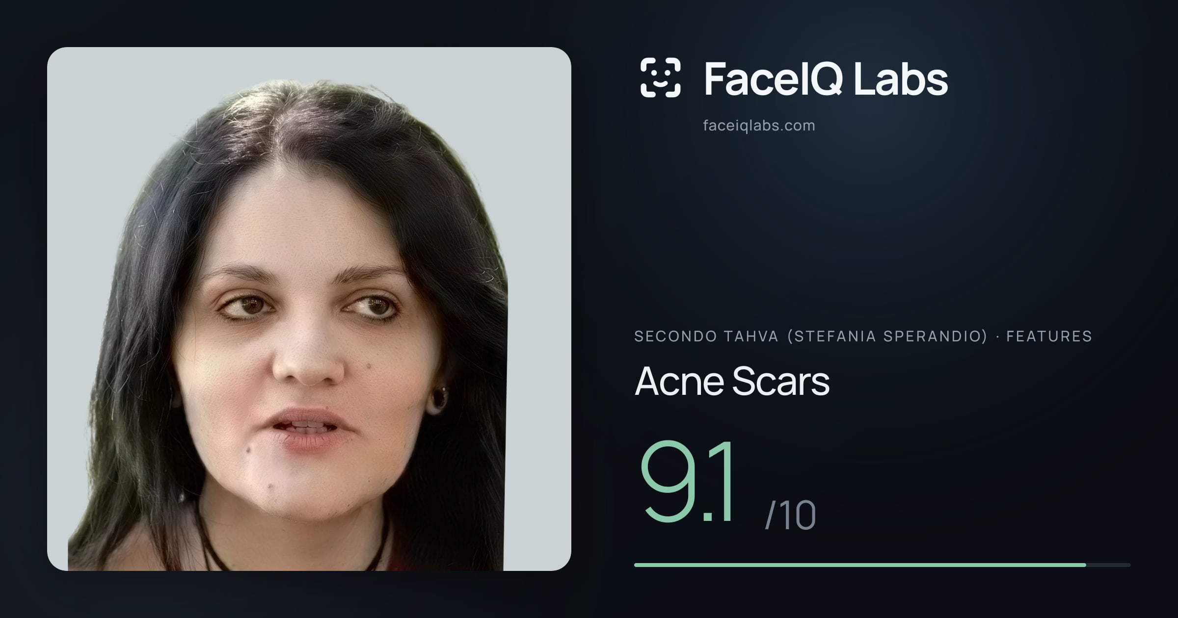 Secondo Tahva (Stefania Sperandio) Acne Scars: 9.1/10, drawn on the photo