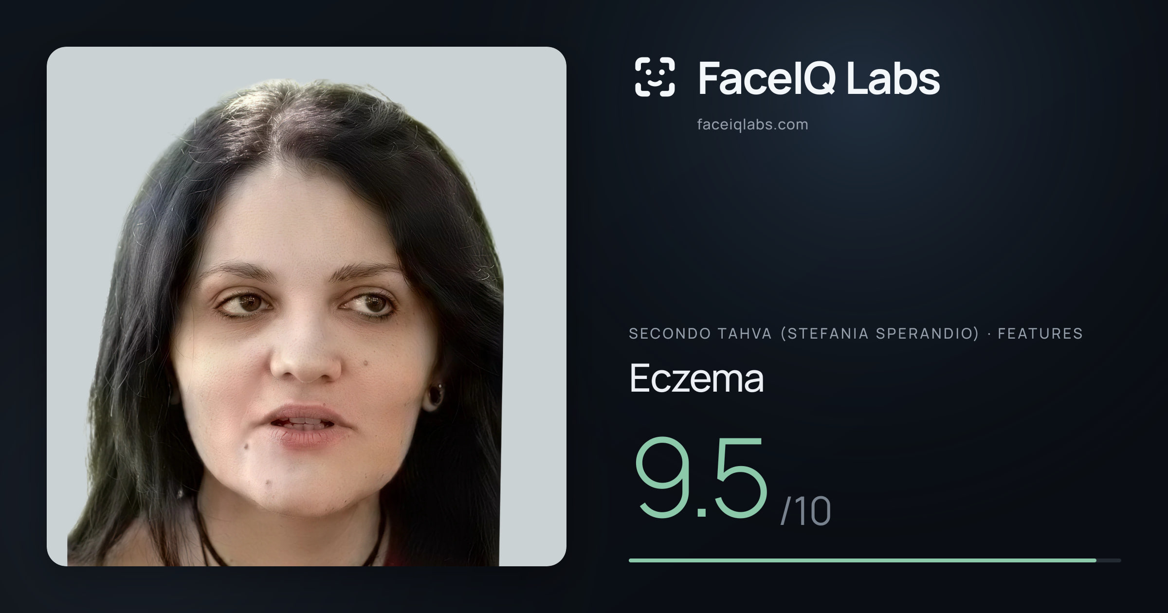 Secondo Tahva (Stefania Sperandio) Eczema: 9.5/10, drawn on the photo