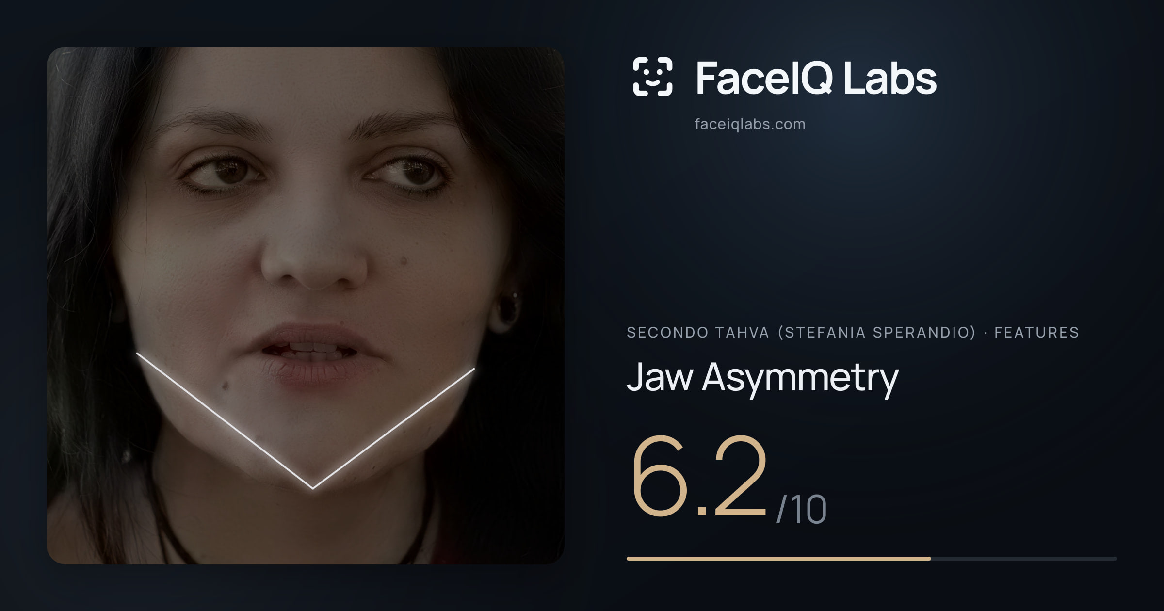 Secondo Tahva (Stefania Sperandio) Jaw Asymmetry: 6.2/10, drawn on the photo