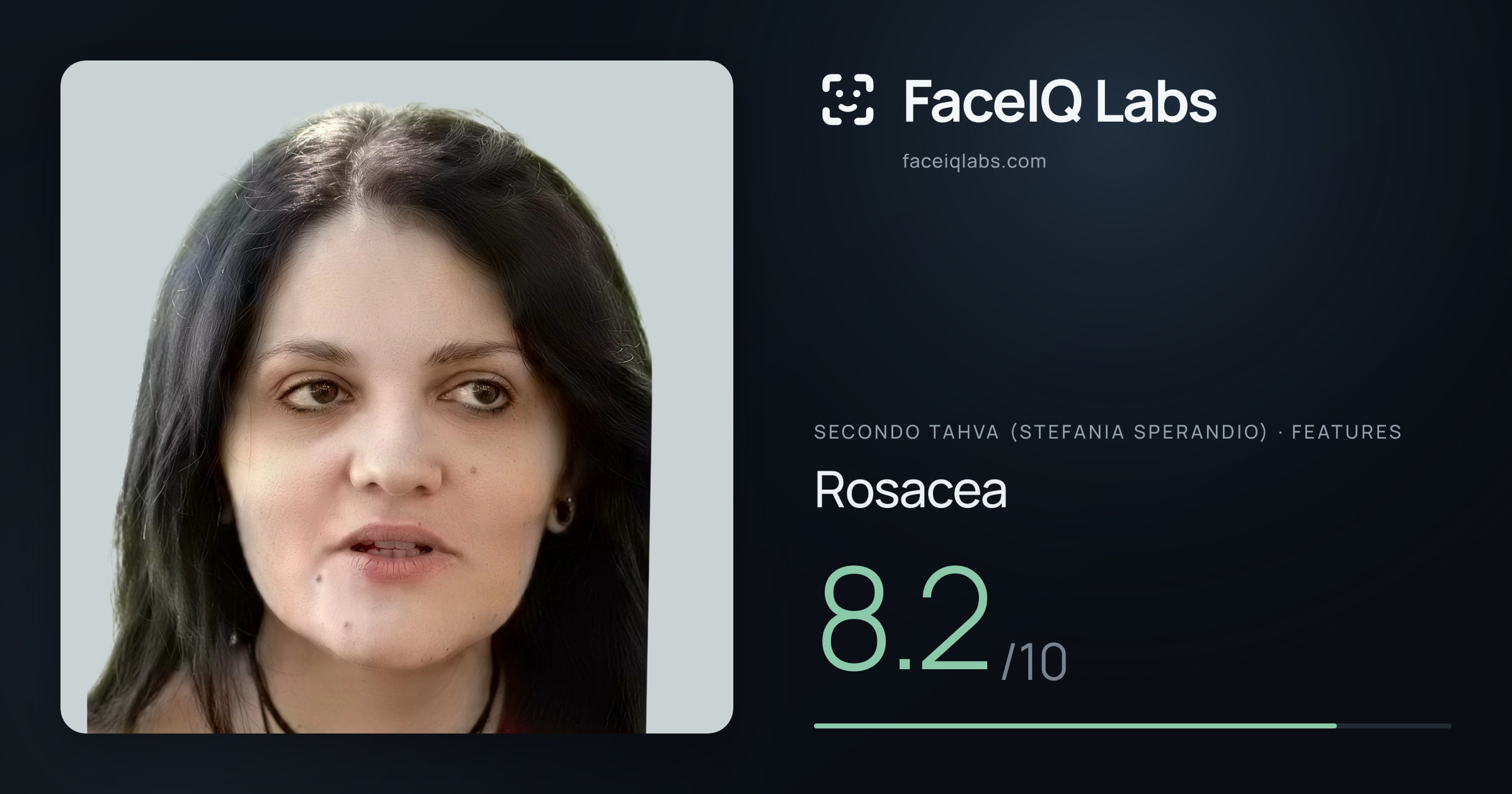 Secondo Tahva (Stefania Sperandio) Rosacea: 8.2/10, drawn on the photo