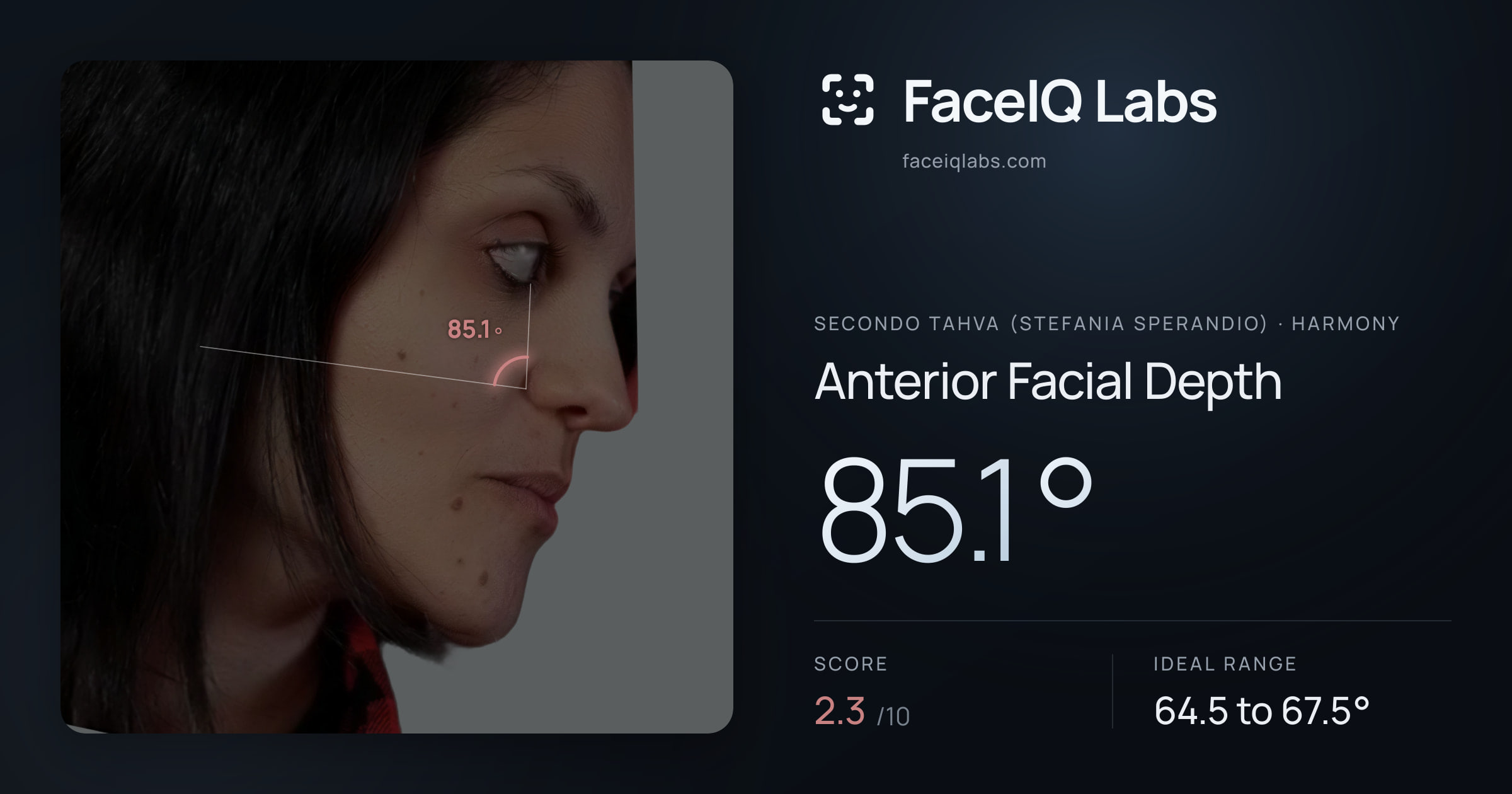 Secondo Tahva (Stefania Sperandio) Anterior Facial Depth: 85.1°, drawn on the photo