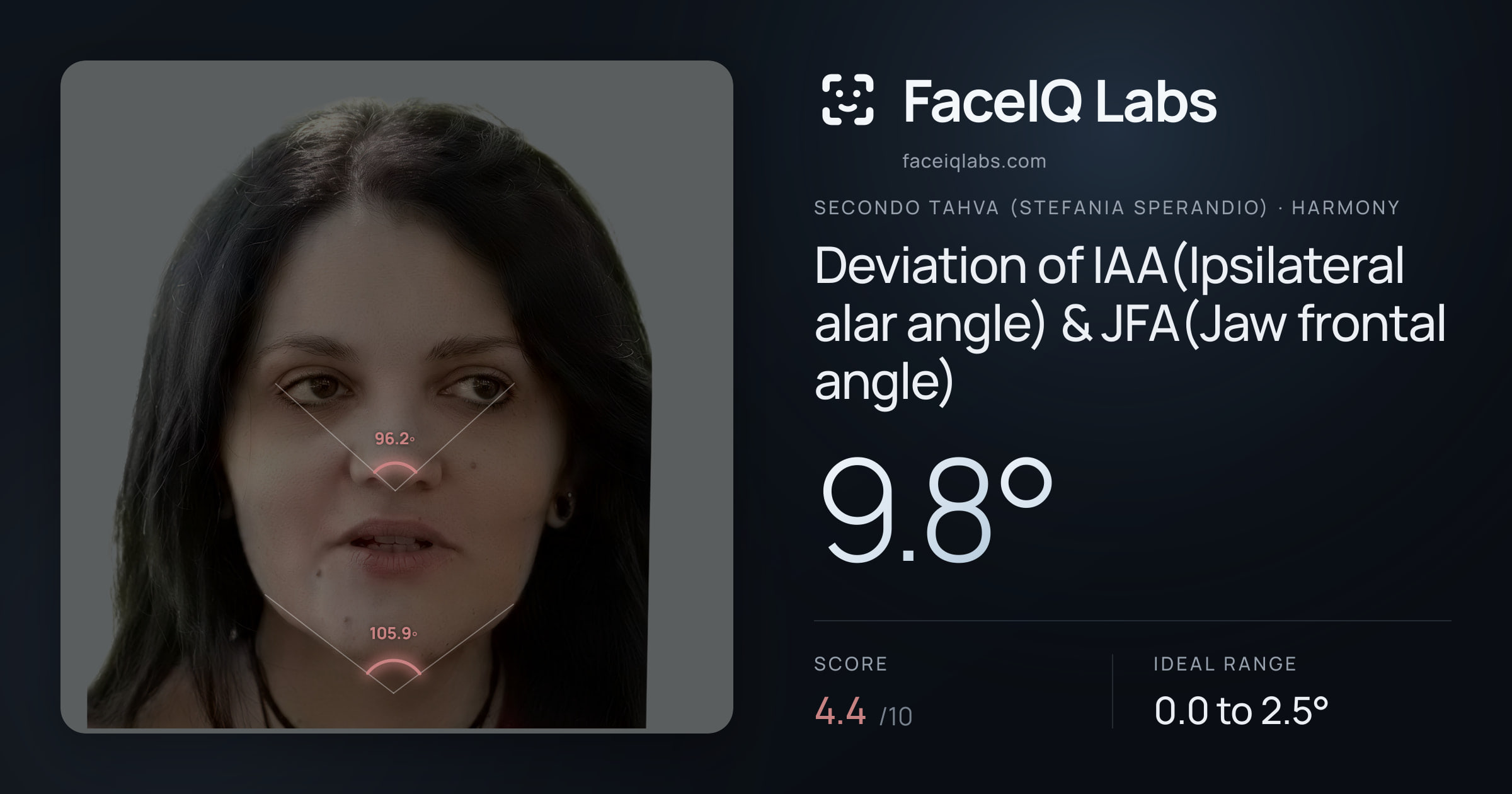 Secondo Tahva (Stefania Sperandio) Deviation of IAA(Ipsilateral alar angle) & JFA(Jaw frontal angle): 9.8°, drawn on the photo