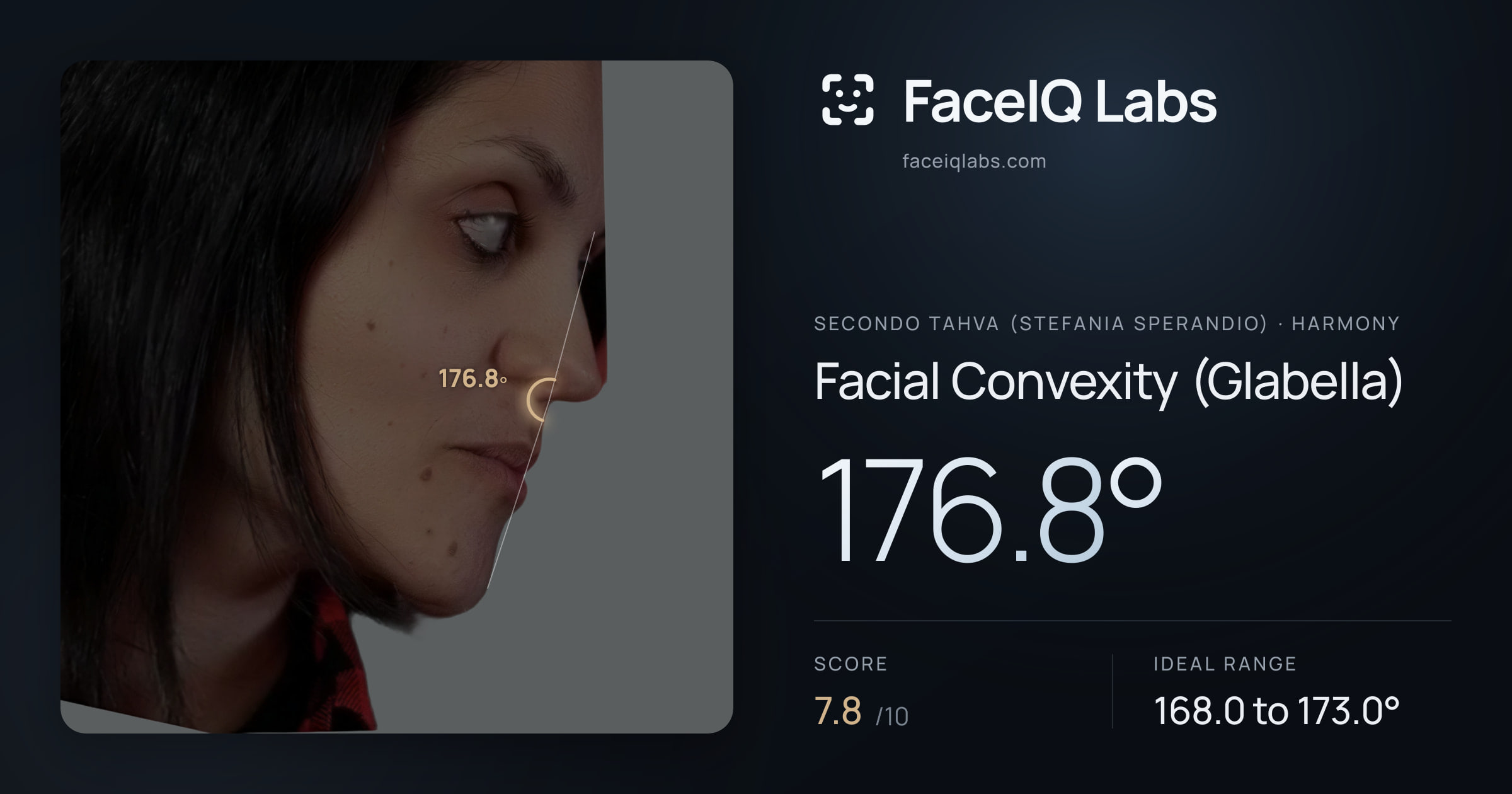 Secondo Tahva (Stefania Sperandio) Facial Convexity (Glabella): 176.8°, drawn on the photo
